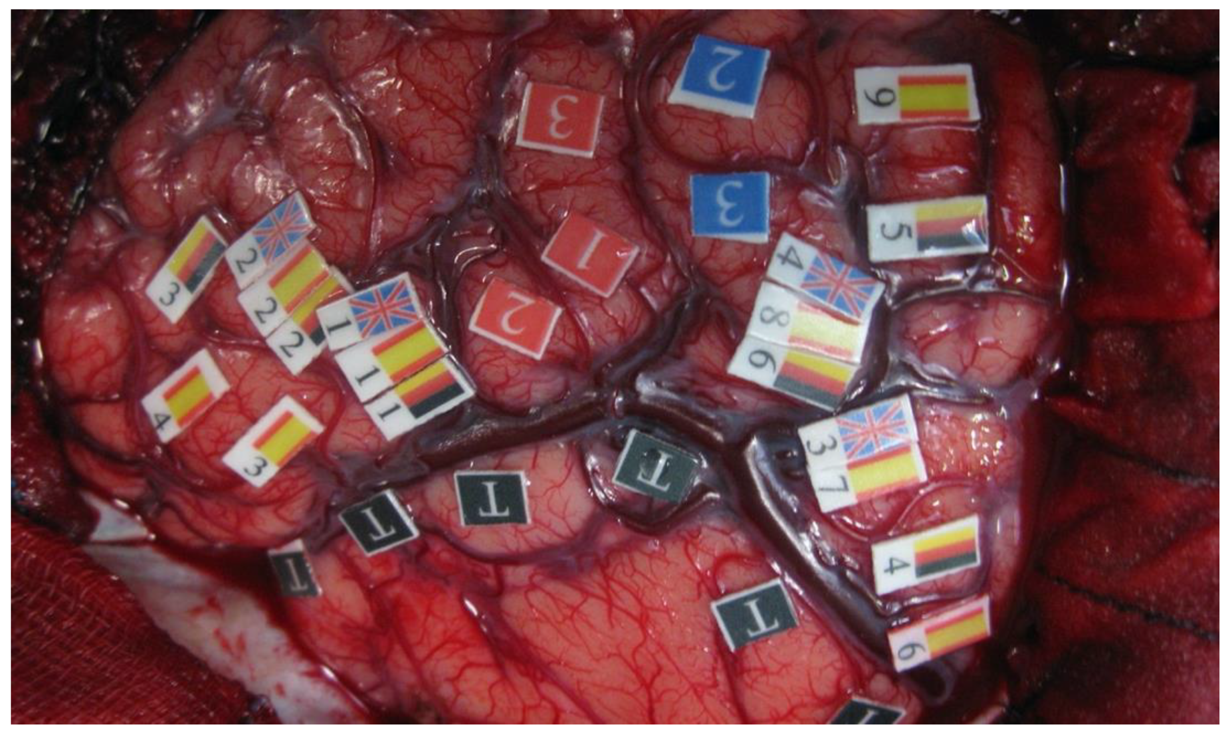 Brainsci 12 00560 g001 Brainsci 12 00560 g001