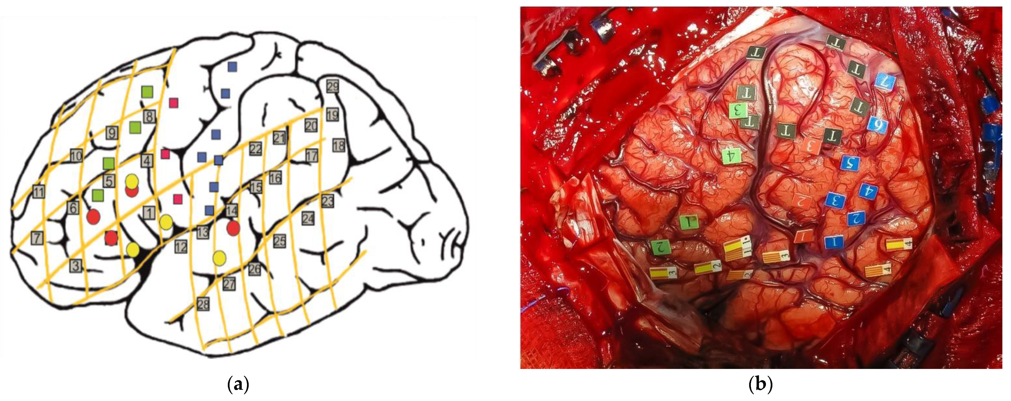 Brainsci 12 00560 g002 Brainsci 12 00560 g002