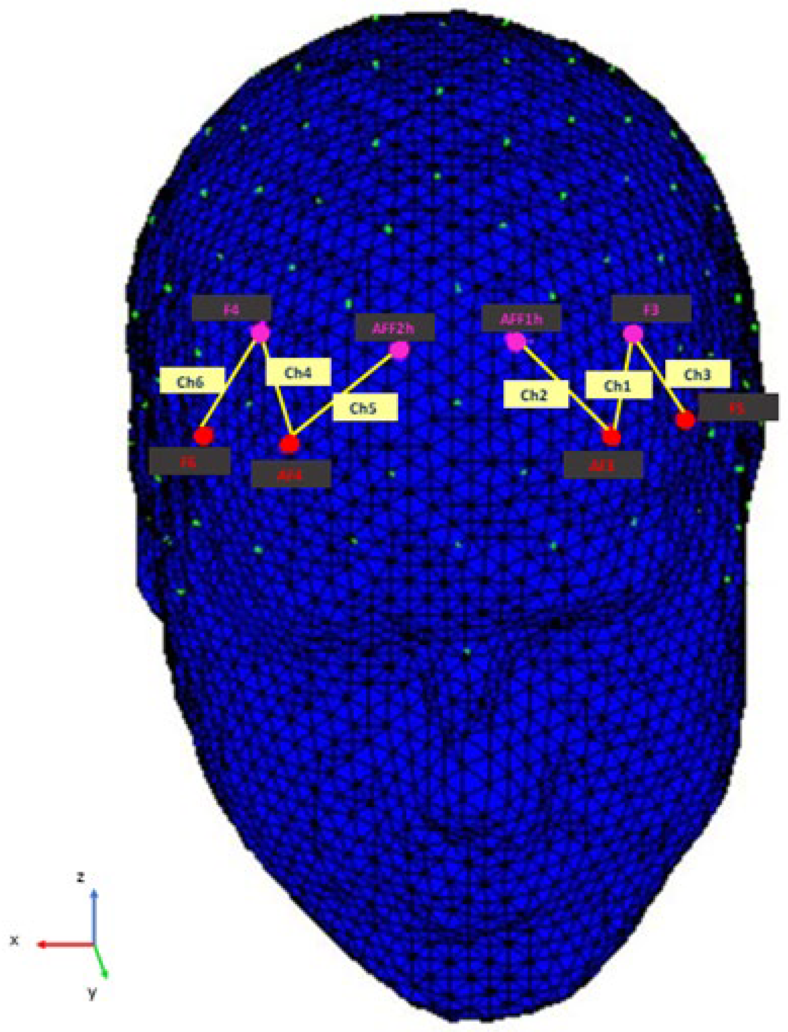 Brainsci 12 00593 g002 550