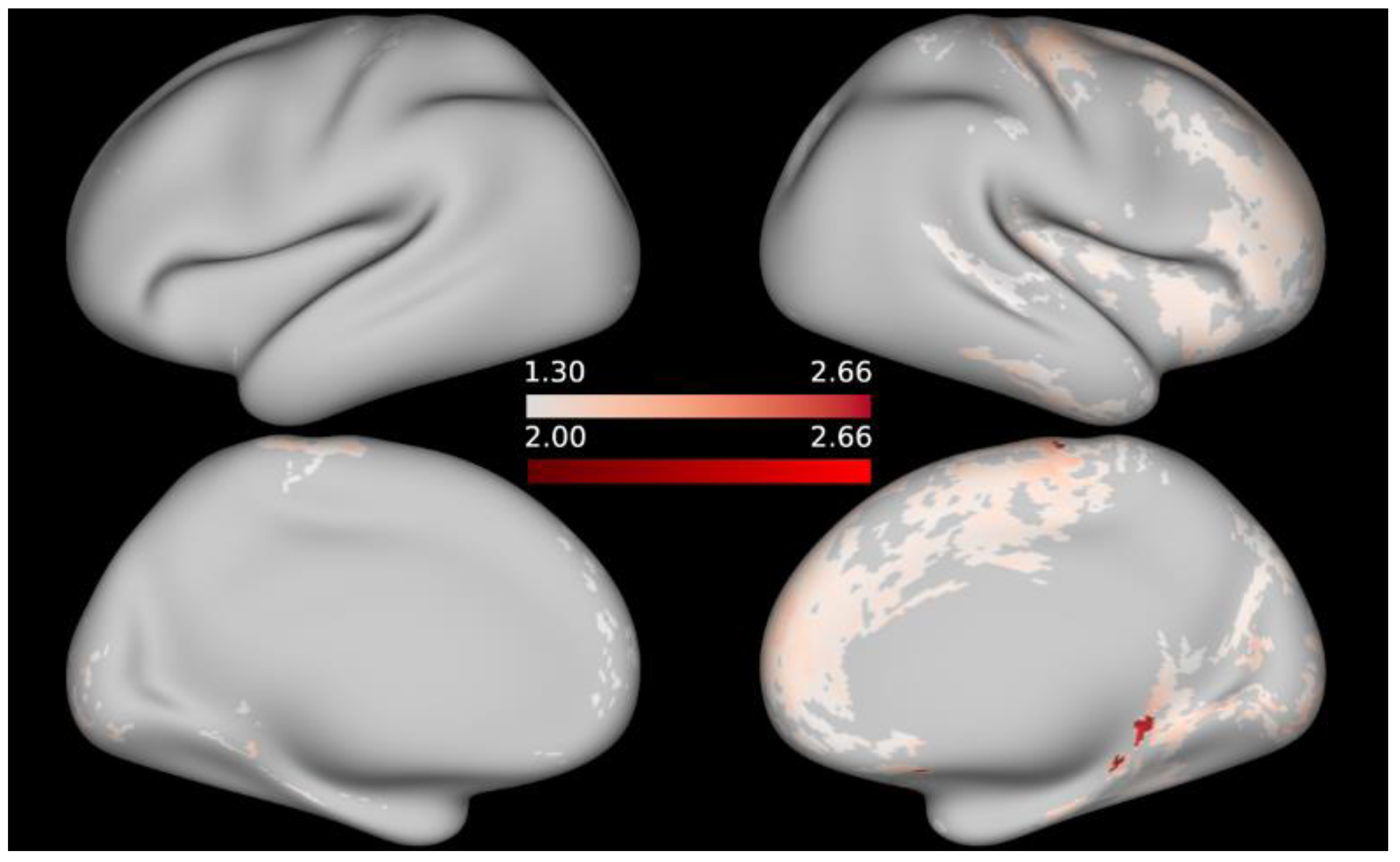 Brainsci 12 00599 g004 550