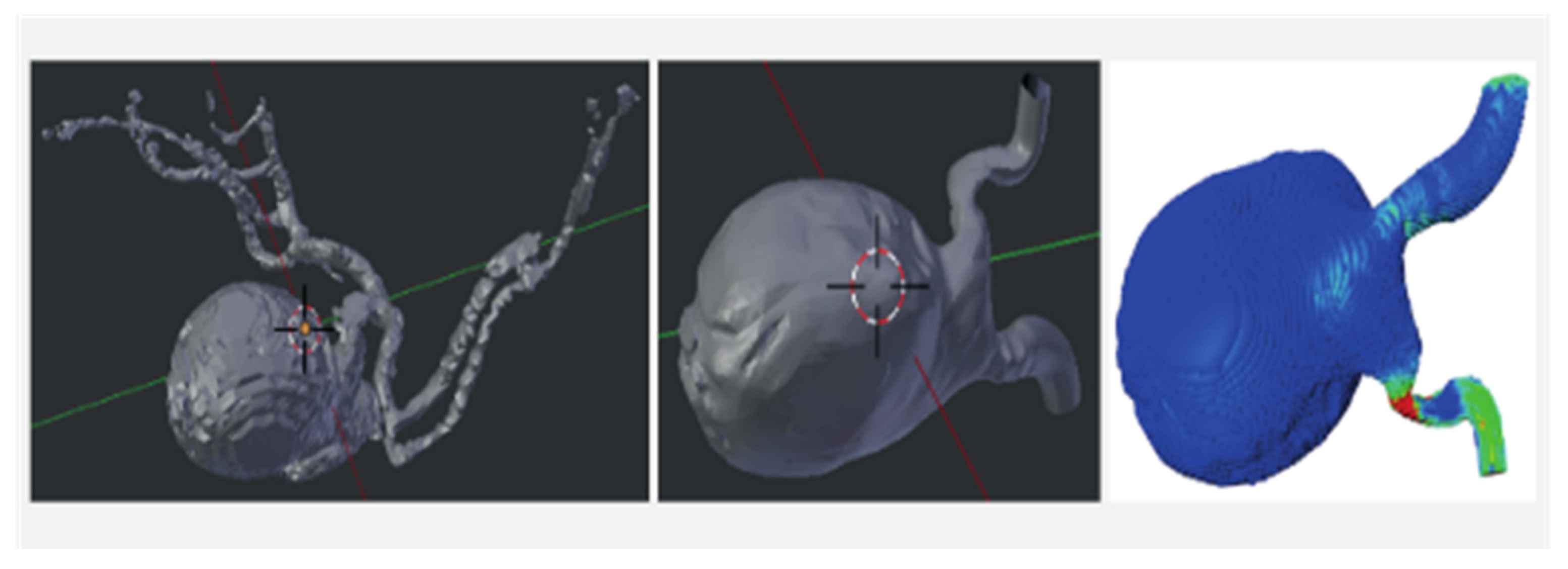Brainsci 12 00603 g002
