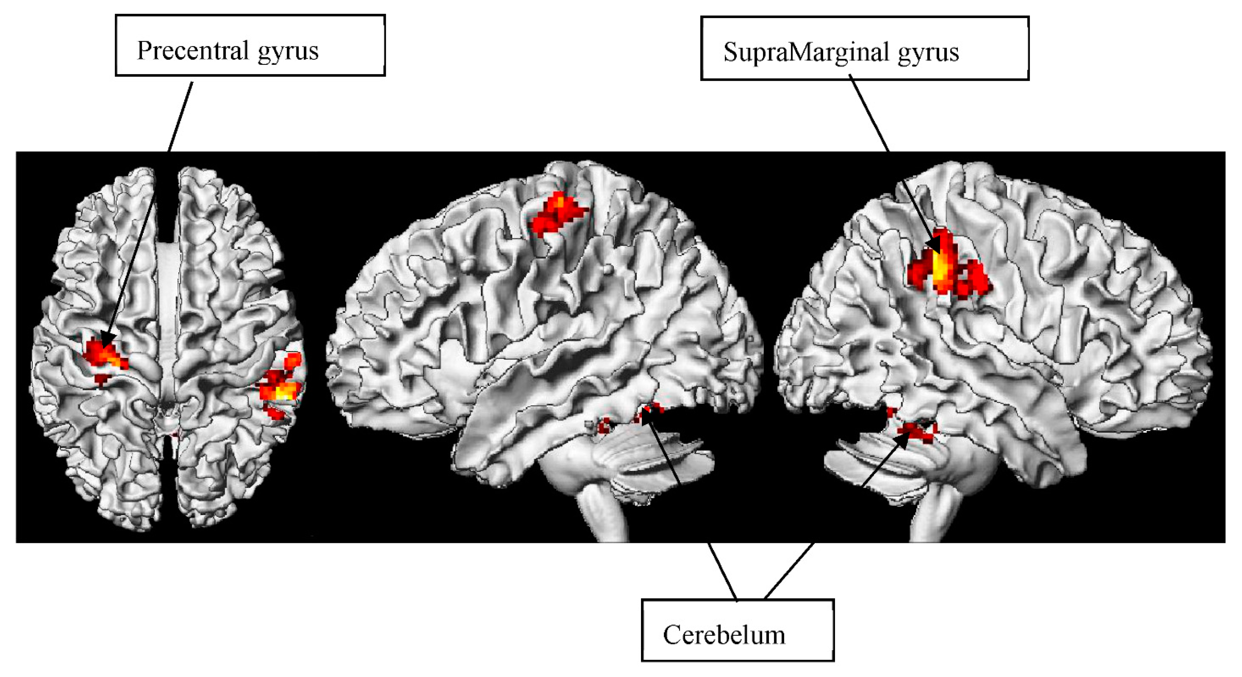 Brainsci 12 00633 g002