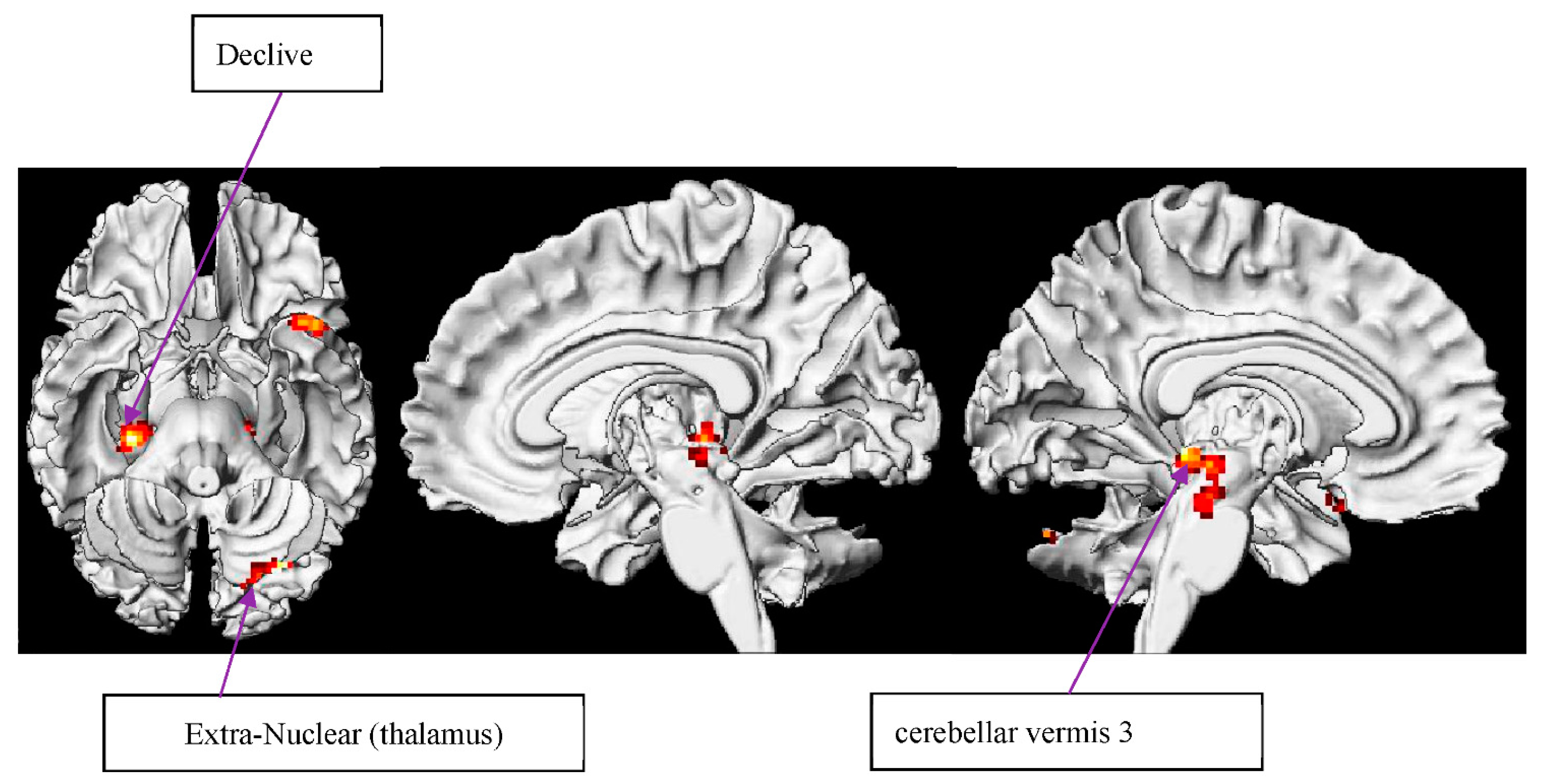 Brainsci 12 00633 g006
