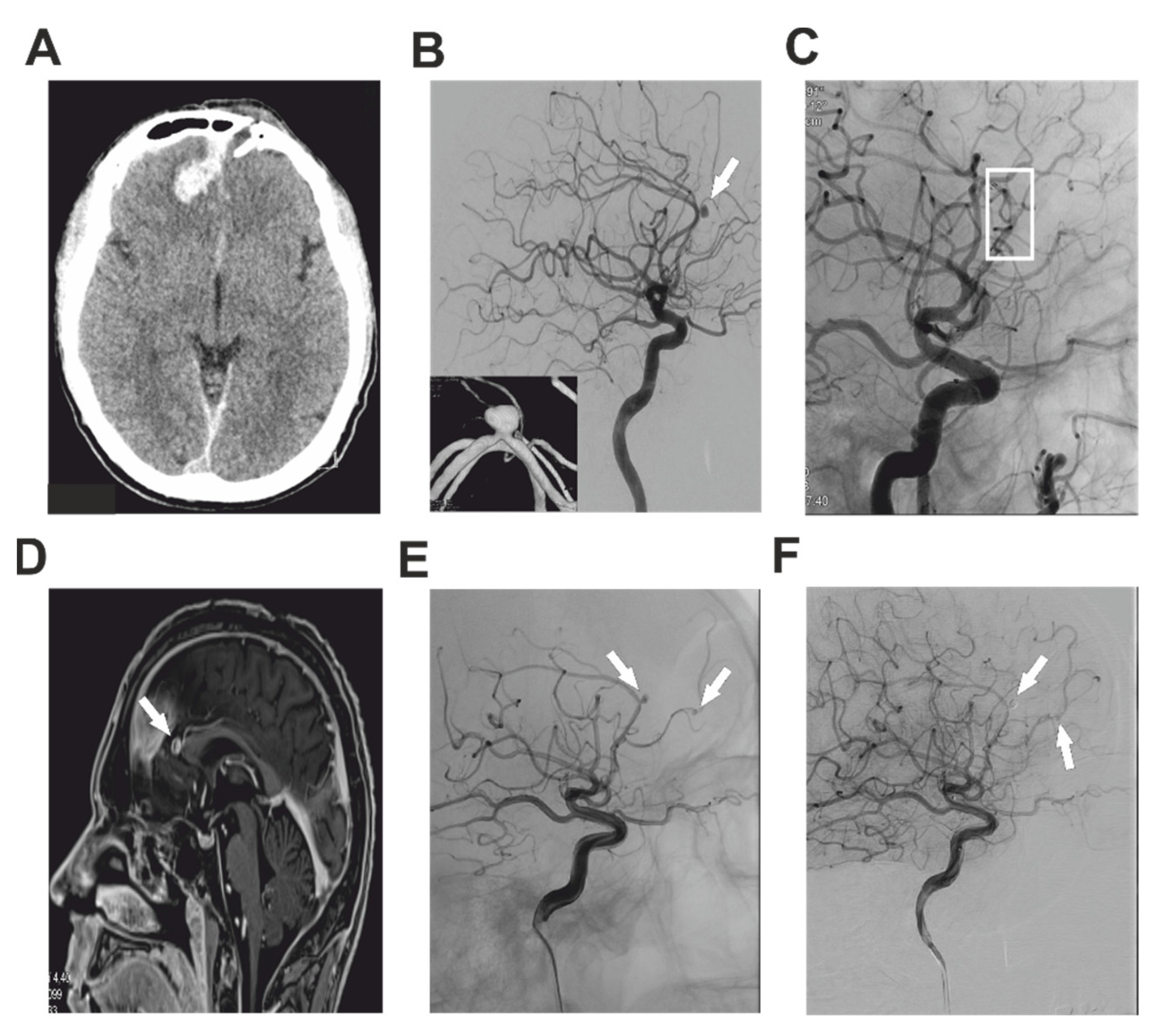 Brainsci 12 00634 g001 550