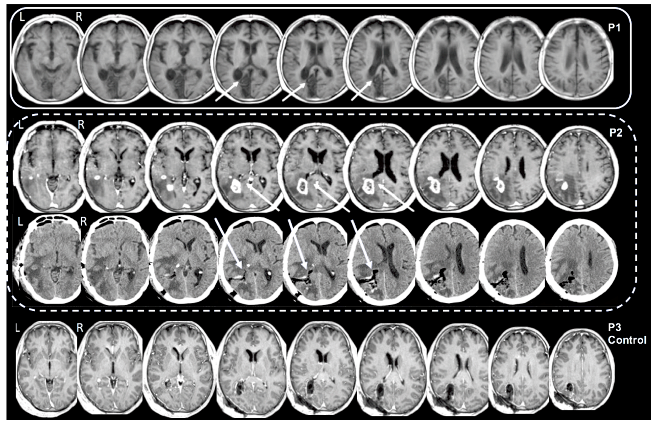 Brainsci 12 00640 g001