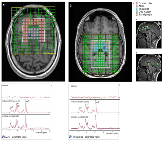 Brain Sciences, Free Full-Text