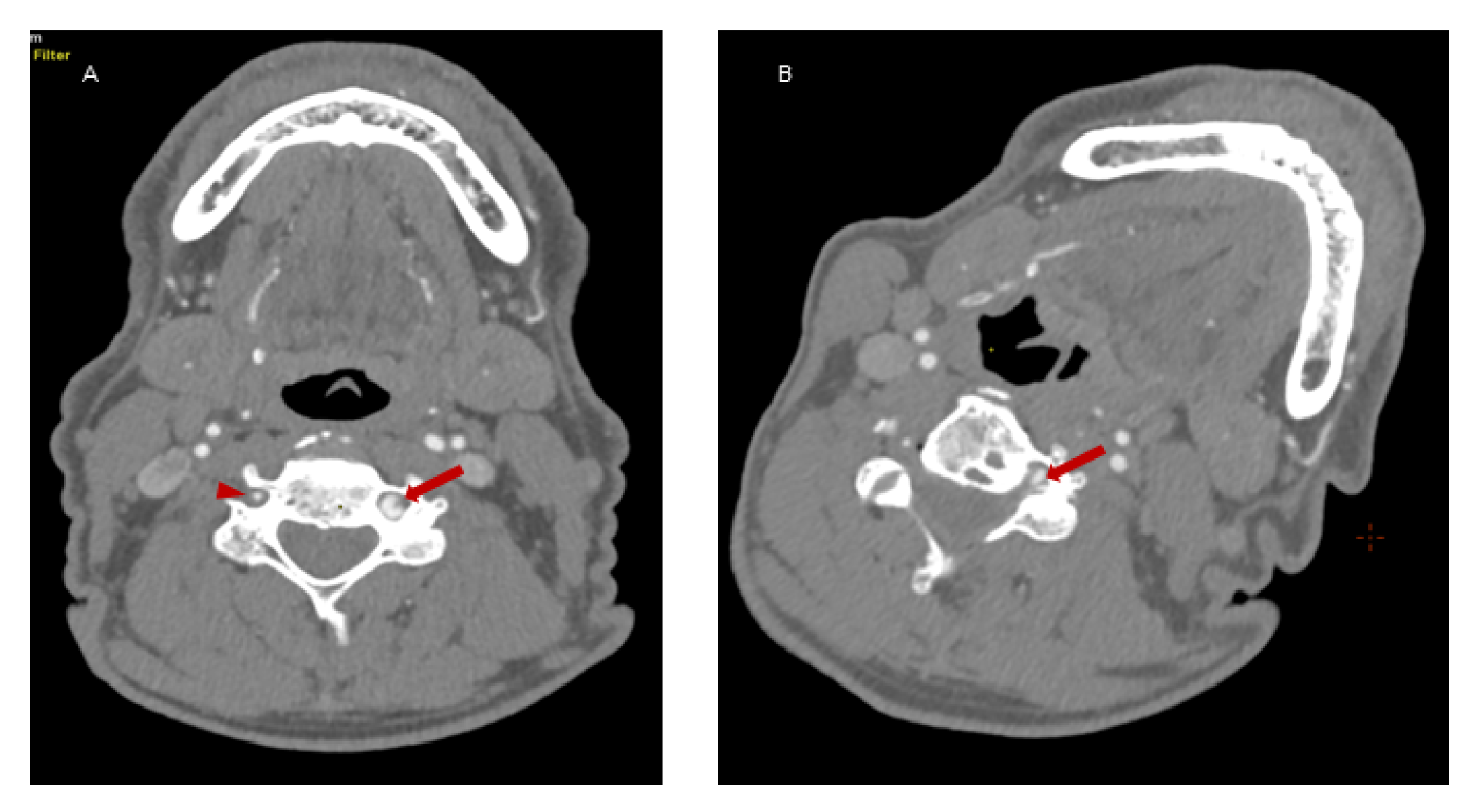 Brainsci 12 00657 g002 550
