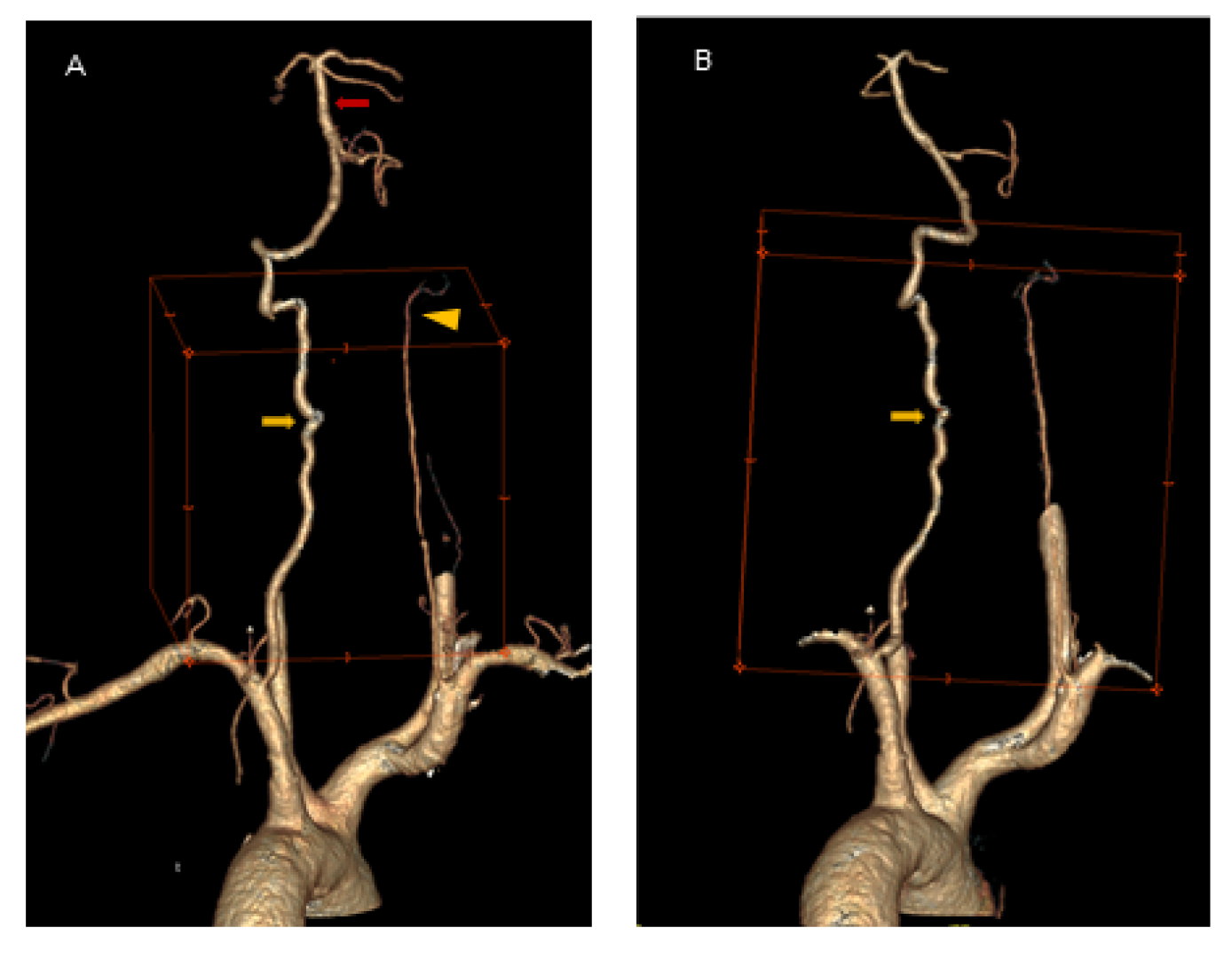 Brainsci 12 00657 g003 550