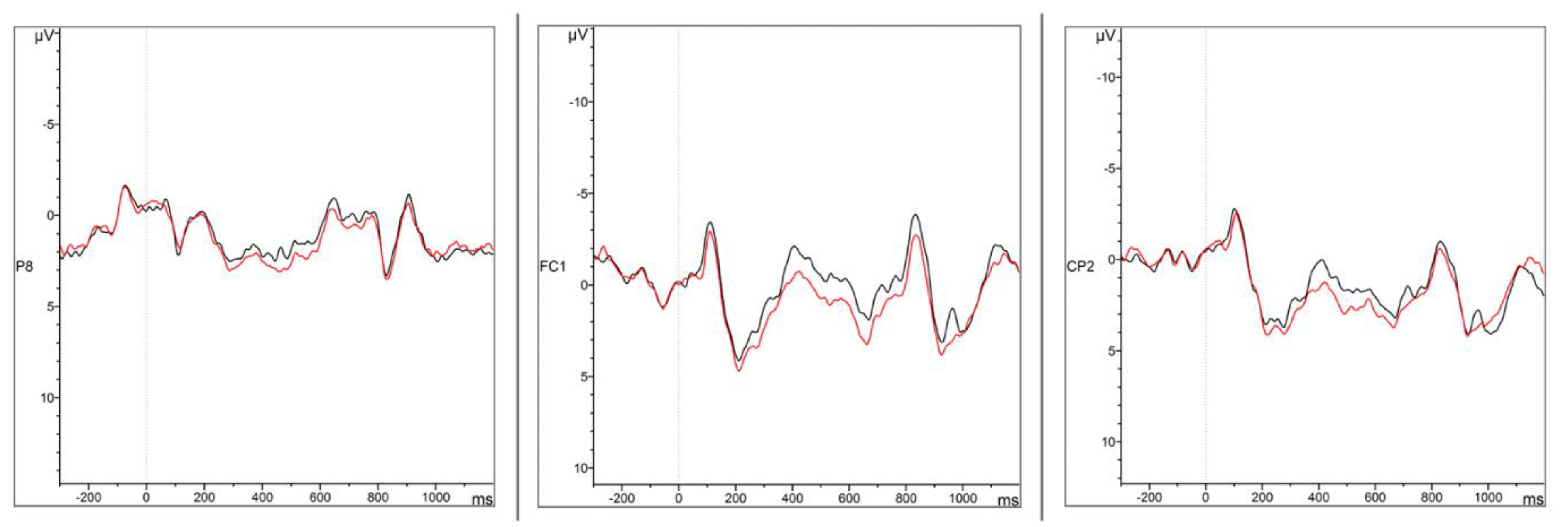 Brainsci 12 00669 g005 Brainsci 12 00669 g005