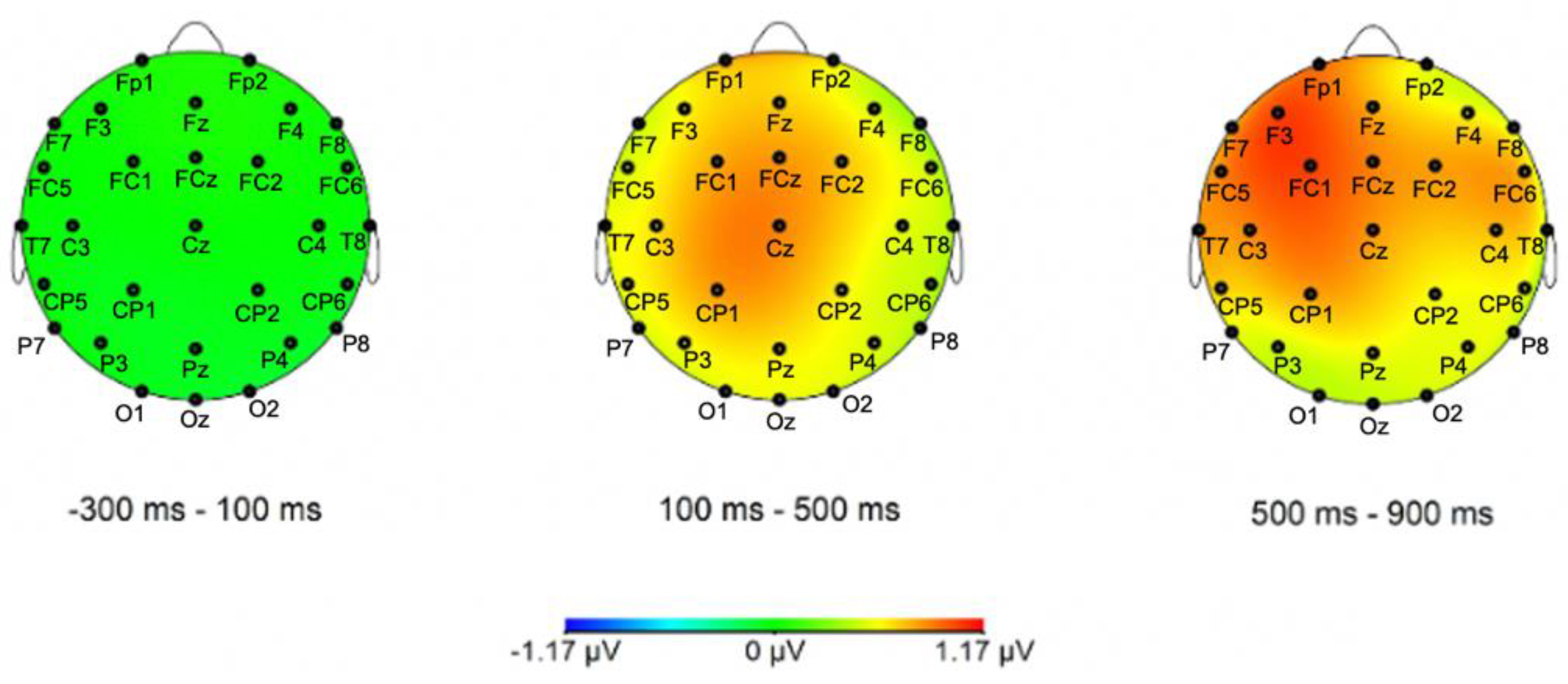 Brainsci 12 00669 g006 Brainsci 12 00669 g006