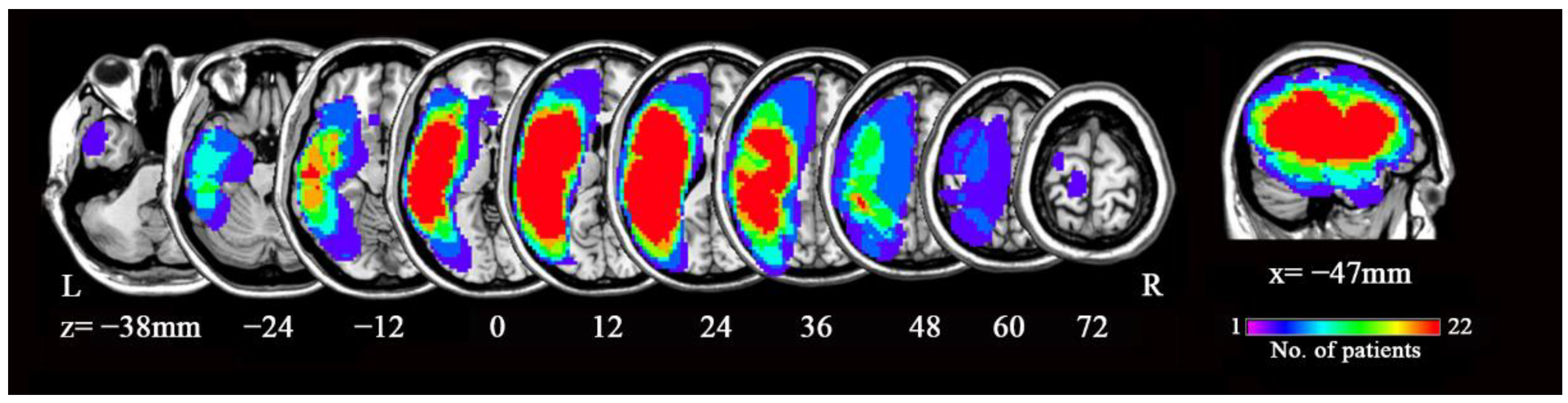 Brainsci 12 00678 g001