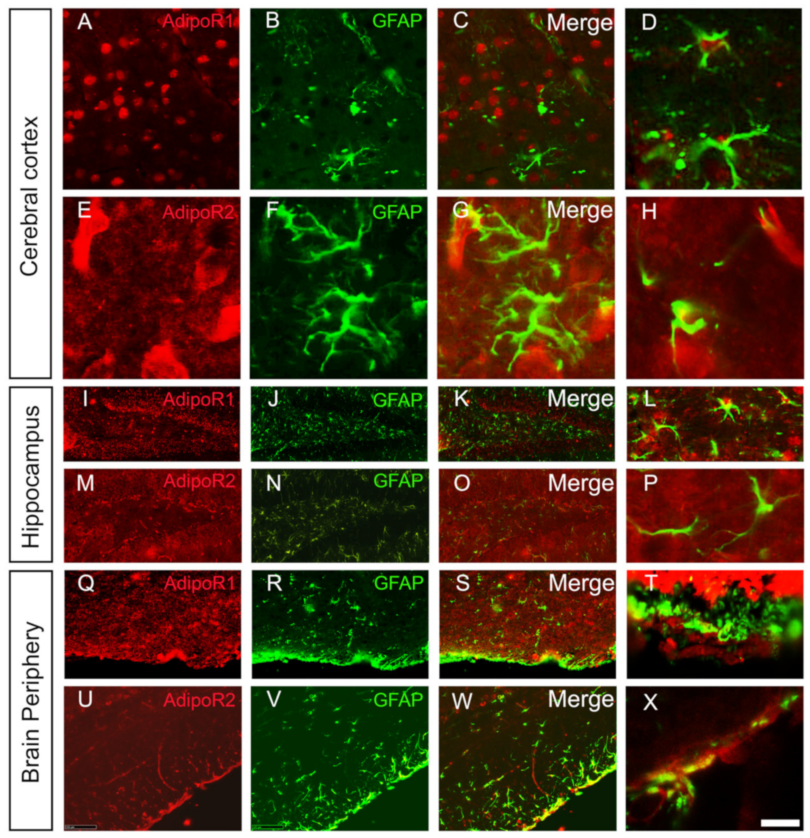 Brainsci 12 00680 g004