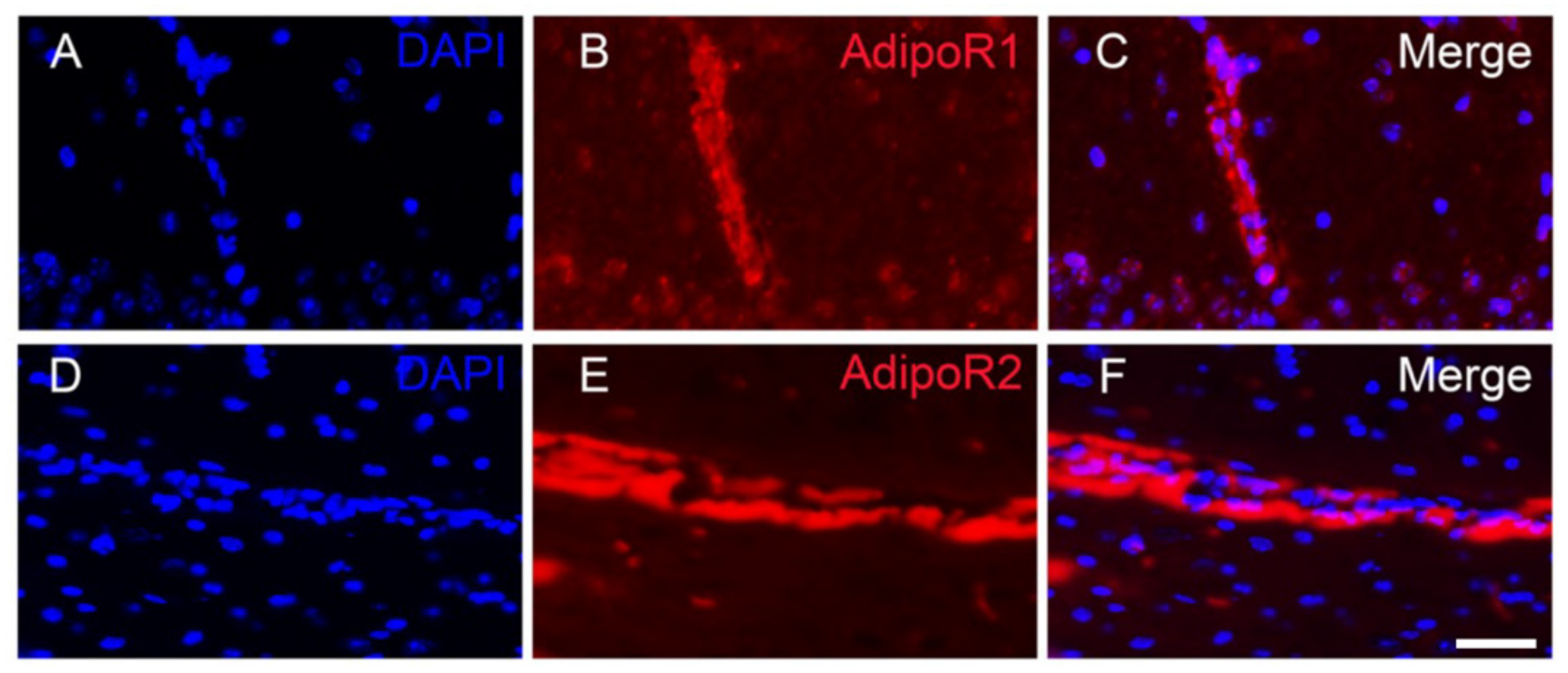 Brainsci 12 00680 g005