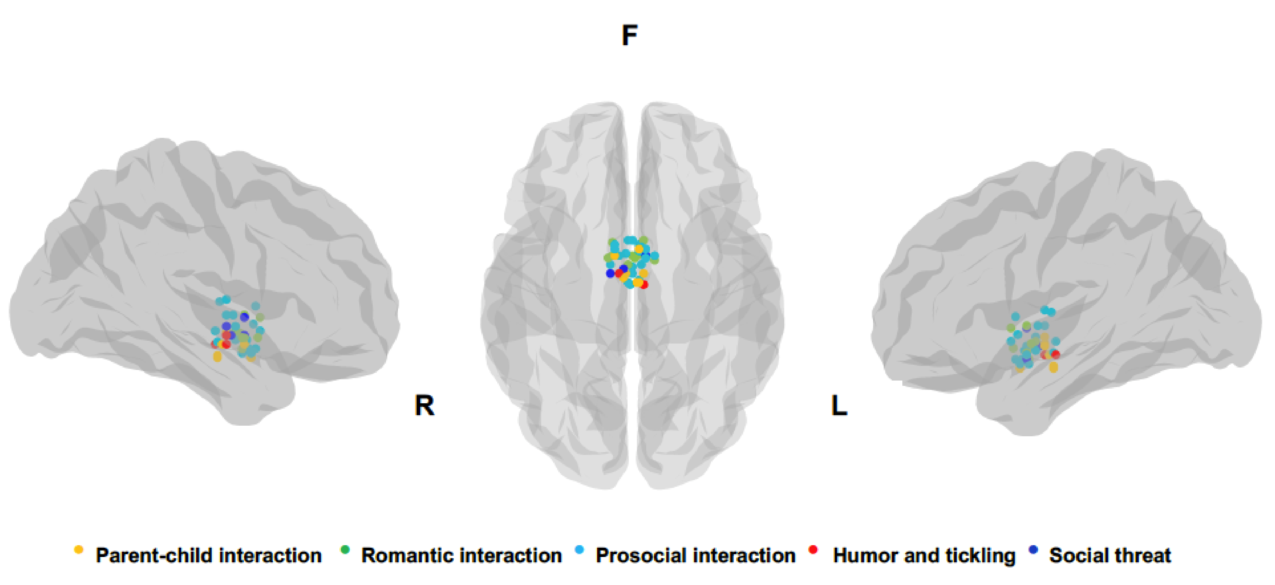 Brainsci 12 00707 g002 Brainsci 12 00707 g002