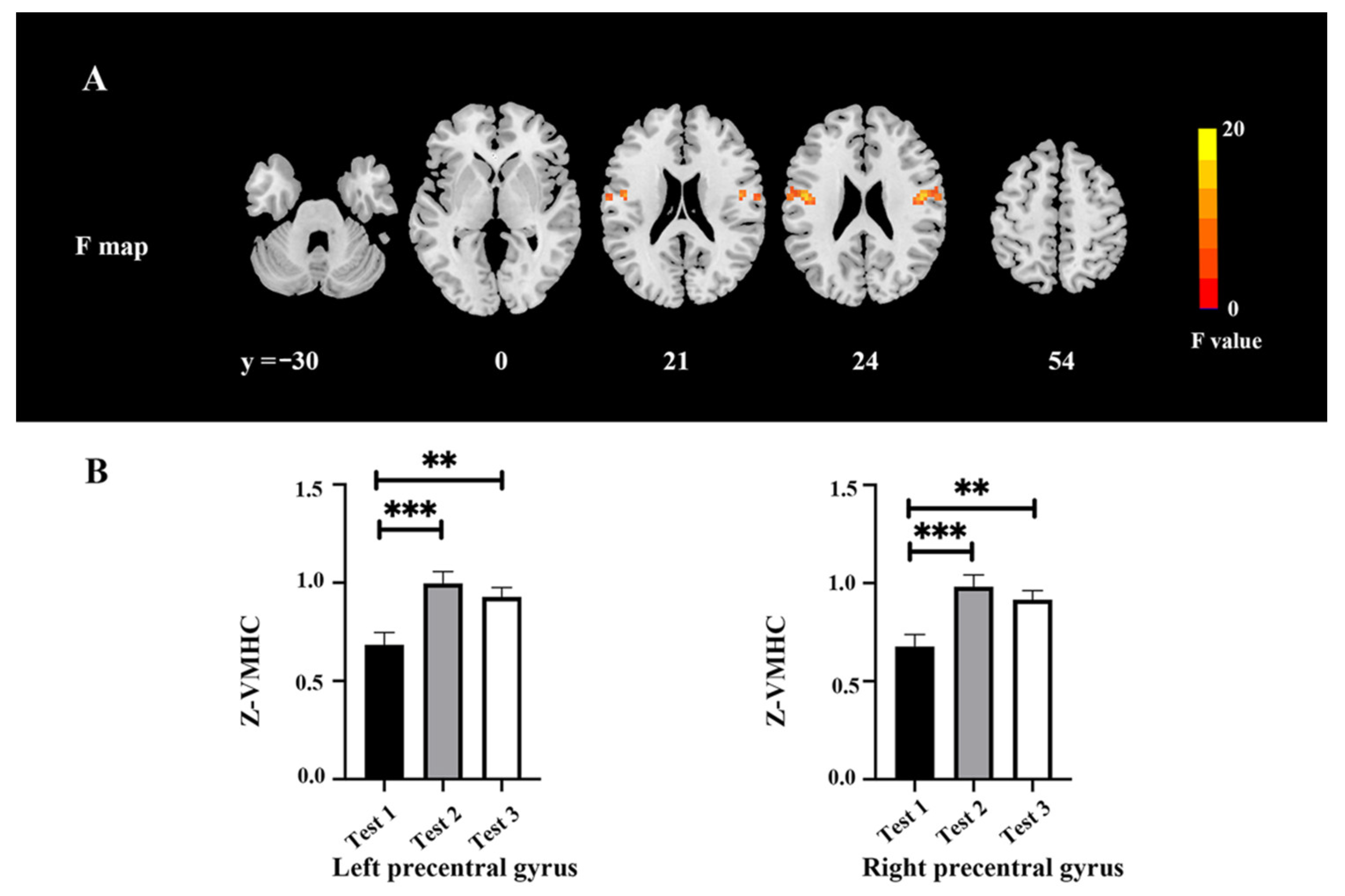 Brainsci 12 00724 g003