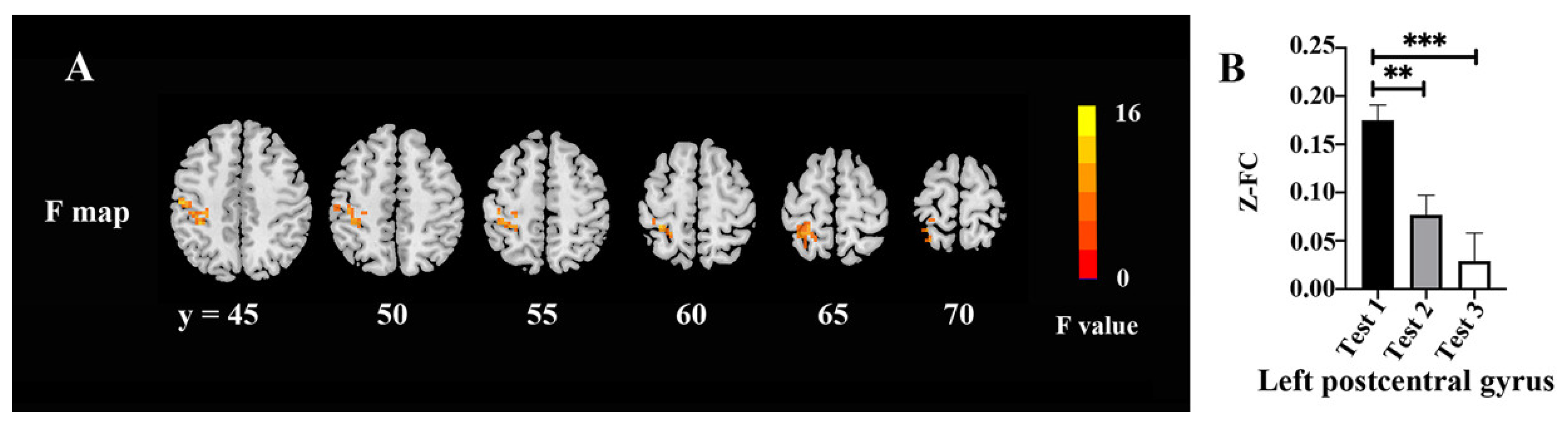 Brainsci 12 00724 g004