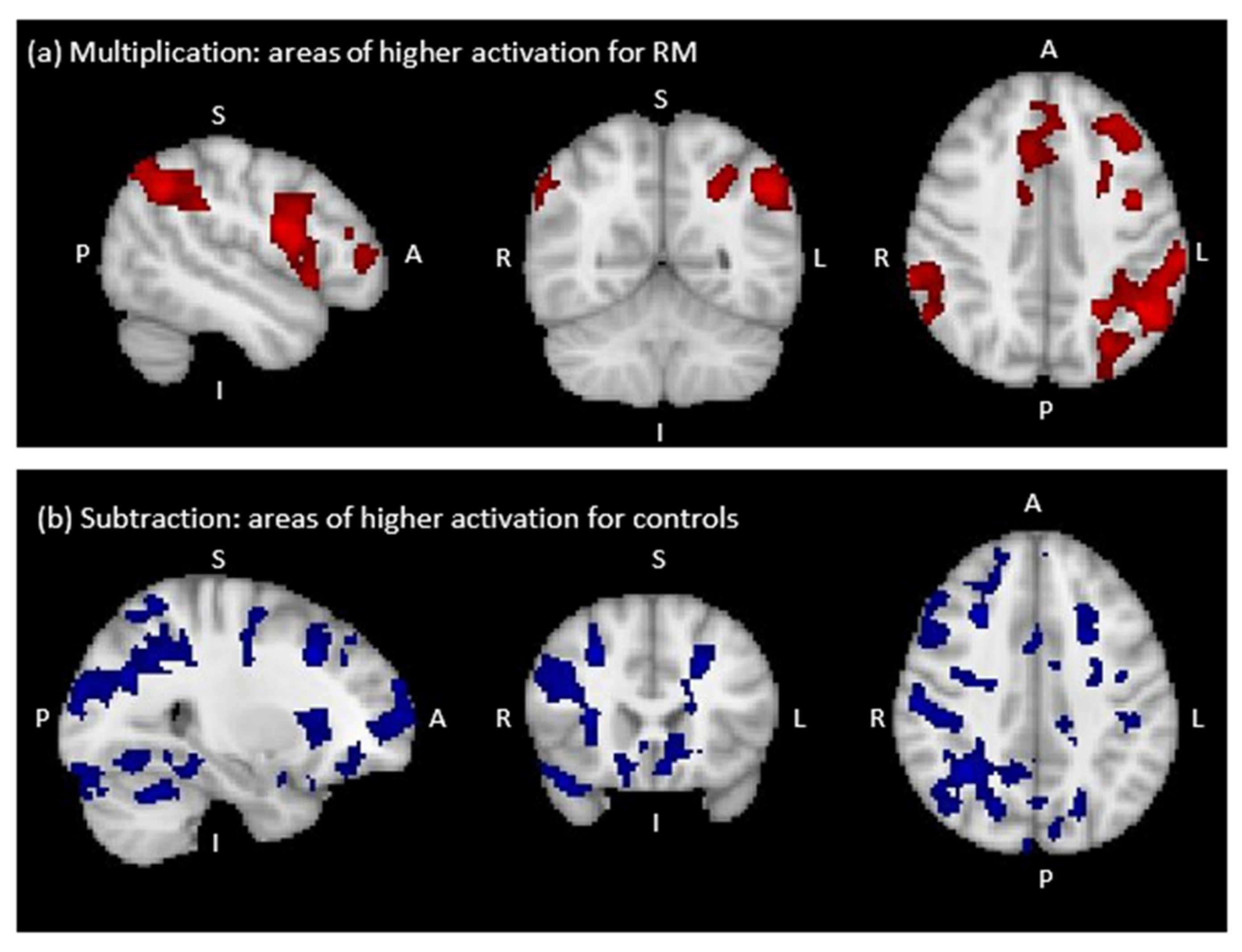 Brainsci 12 00735 g004 Brainsci 12 00735 g004