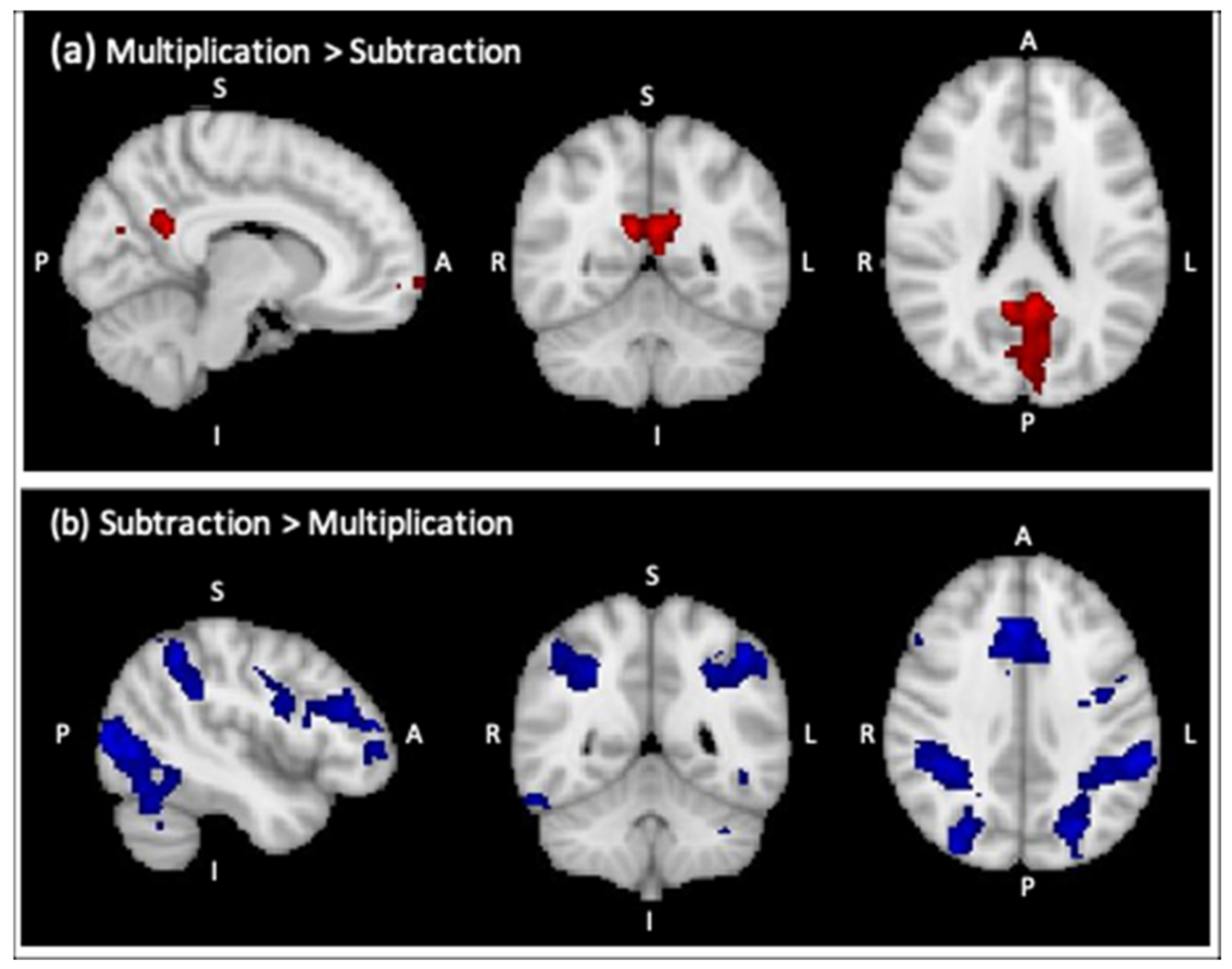 Brainsci 12 00735 g0a1 Brainsci 12 00735 g0a1