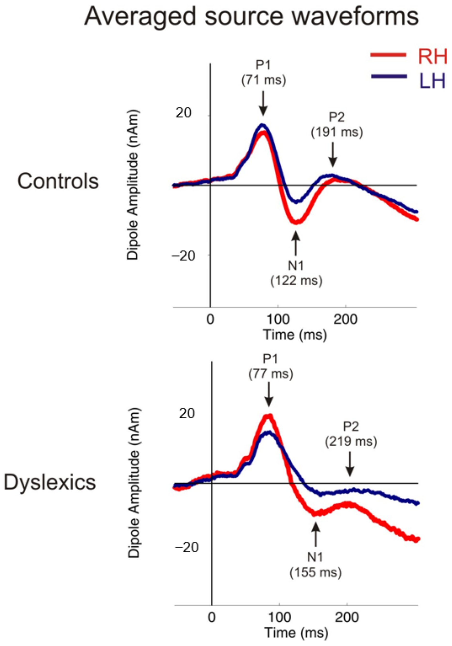 Brainsci 12 00744 g001 Brainsci 12 00744 g001