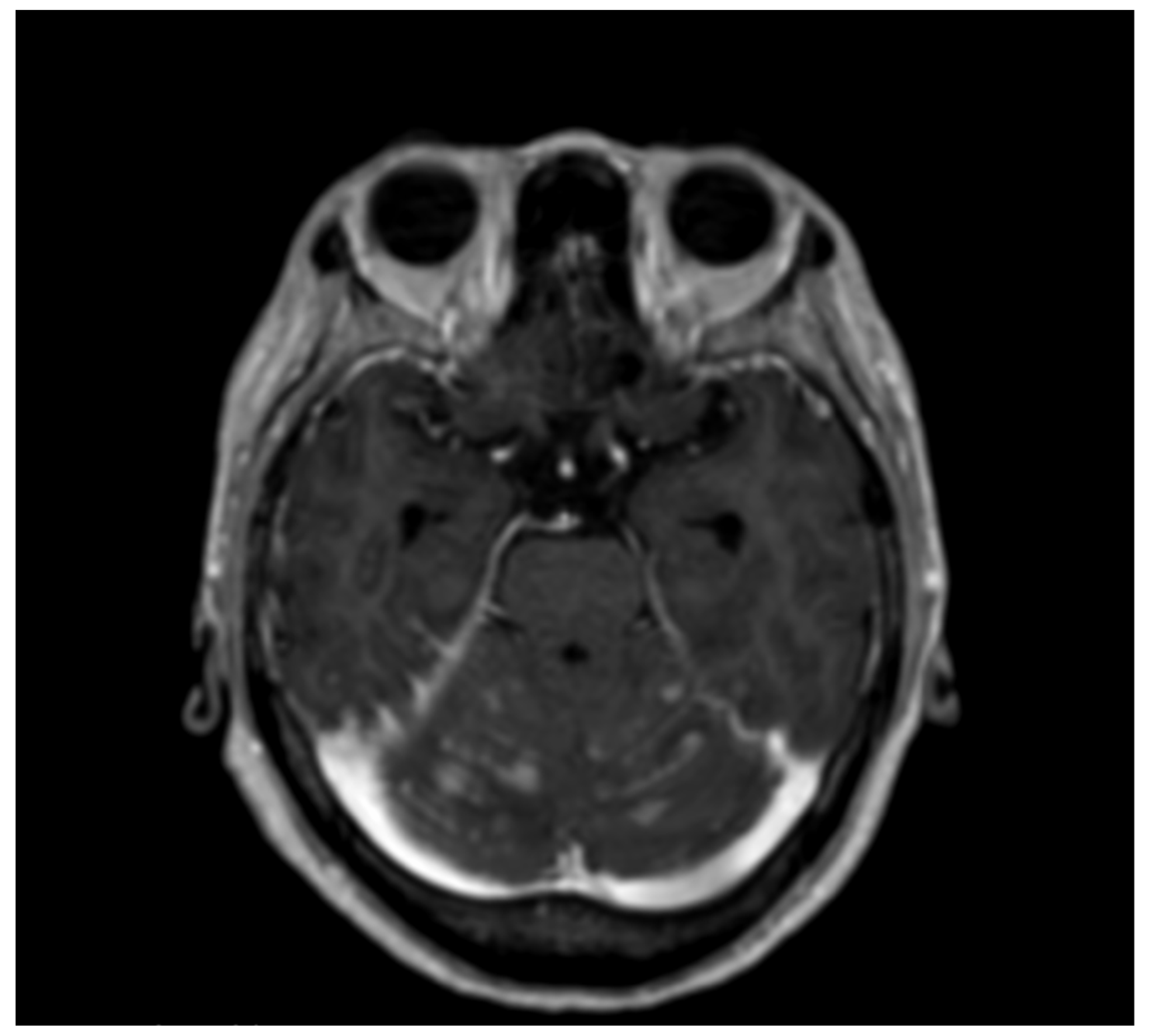 Brainsci 12 00748 g001