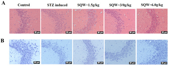 Shen Qi Wan Ameliorates Learning and Memory Impairment