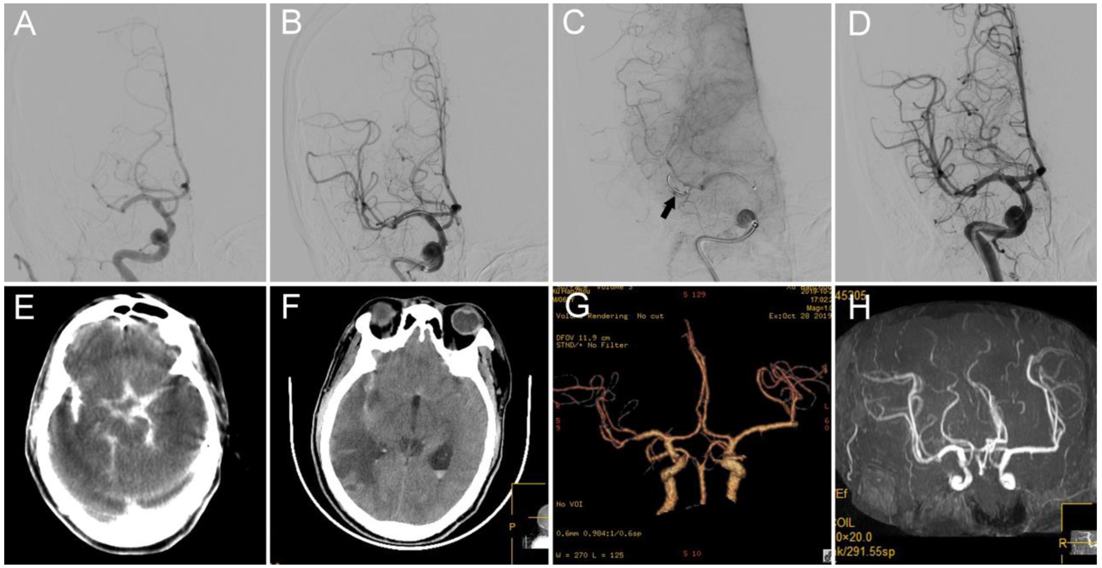 Brainsci 12 00760 g003