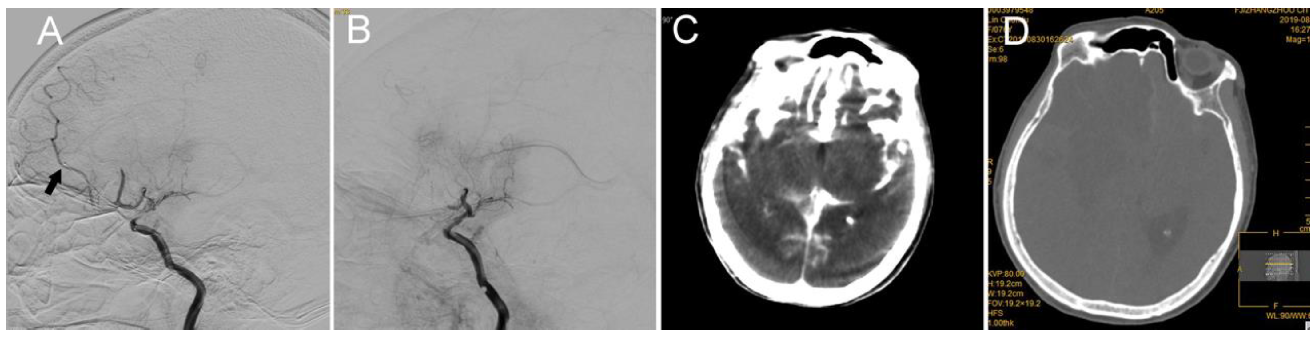 Brainsci 12 00760 g005