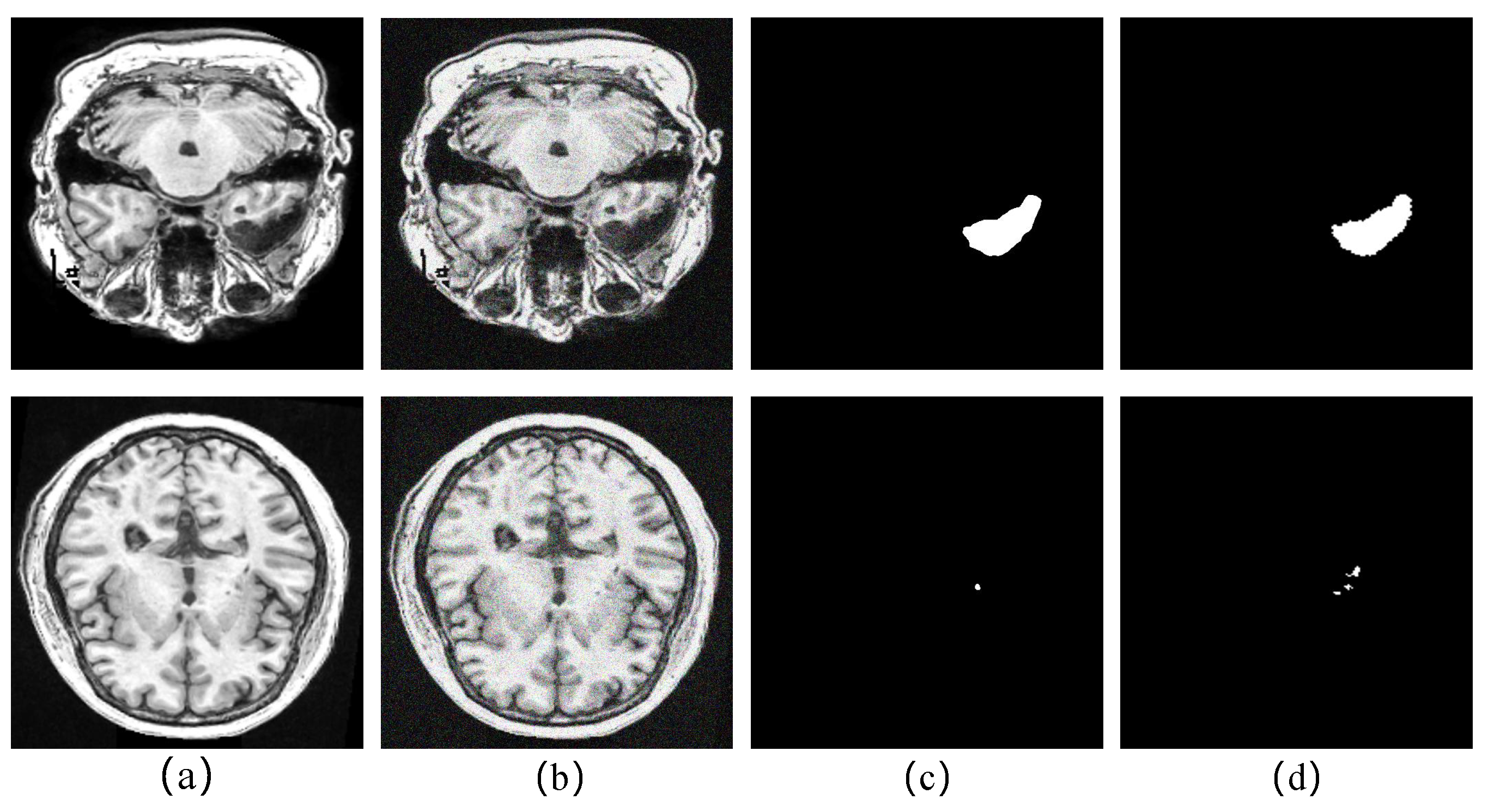 Brainsci 12 00765 g007 550