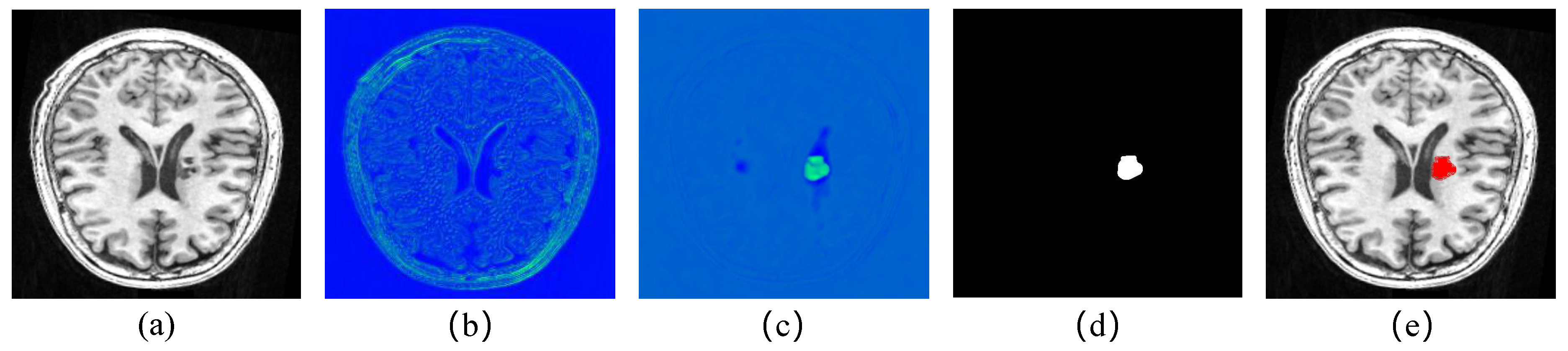 Brainsci 12 00765 g008 550