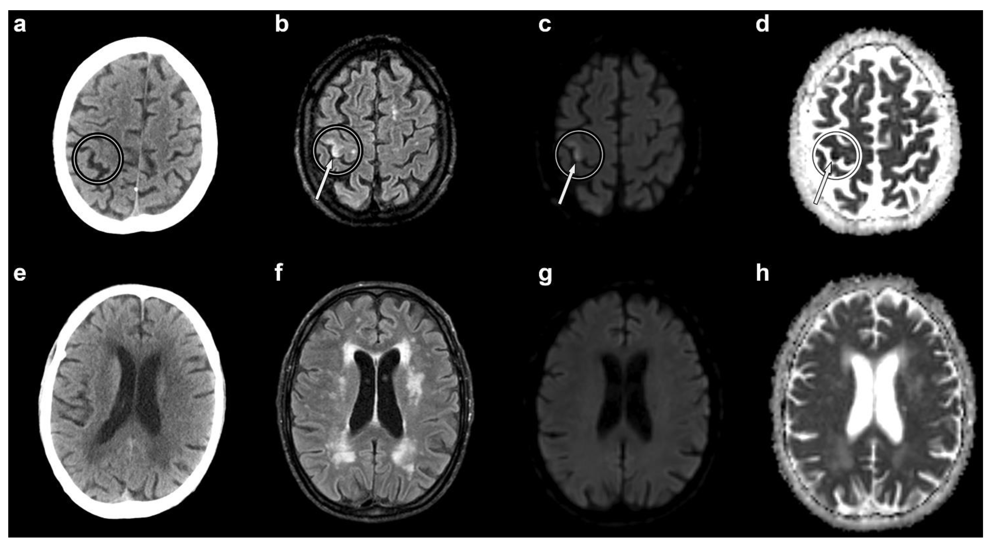 Brainsci 12 00772 g001 550