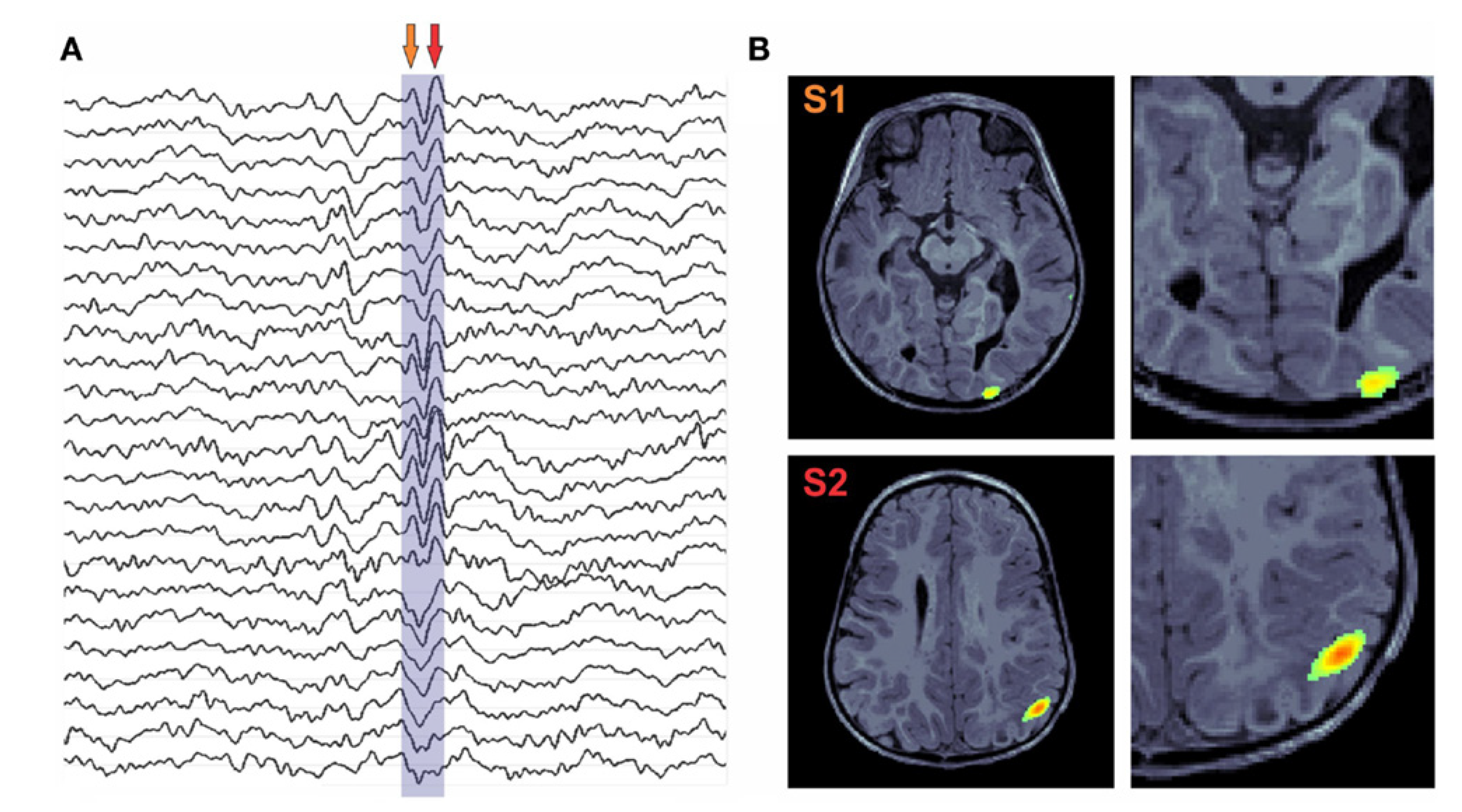 Brainsci 12 00788 g005