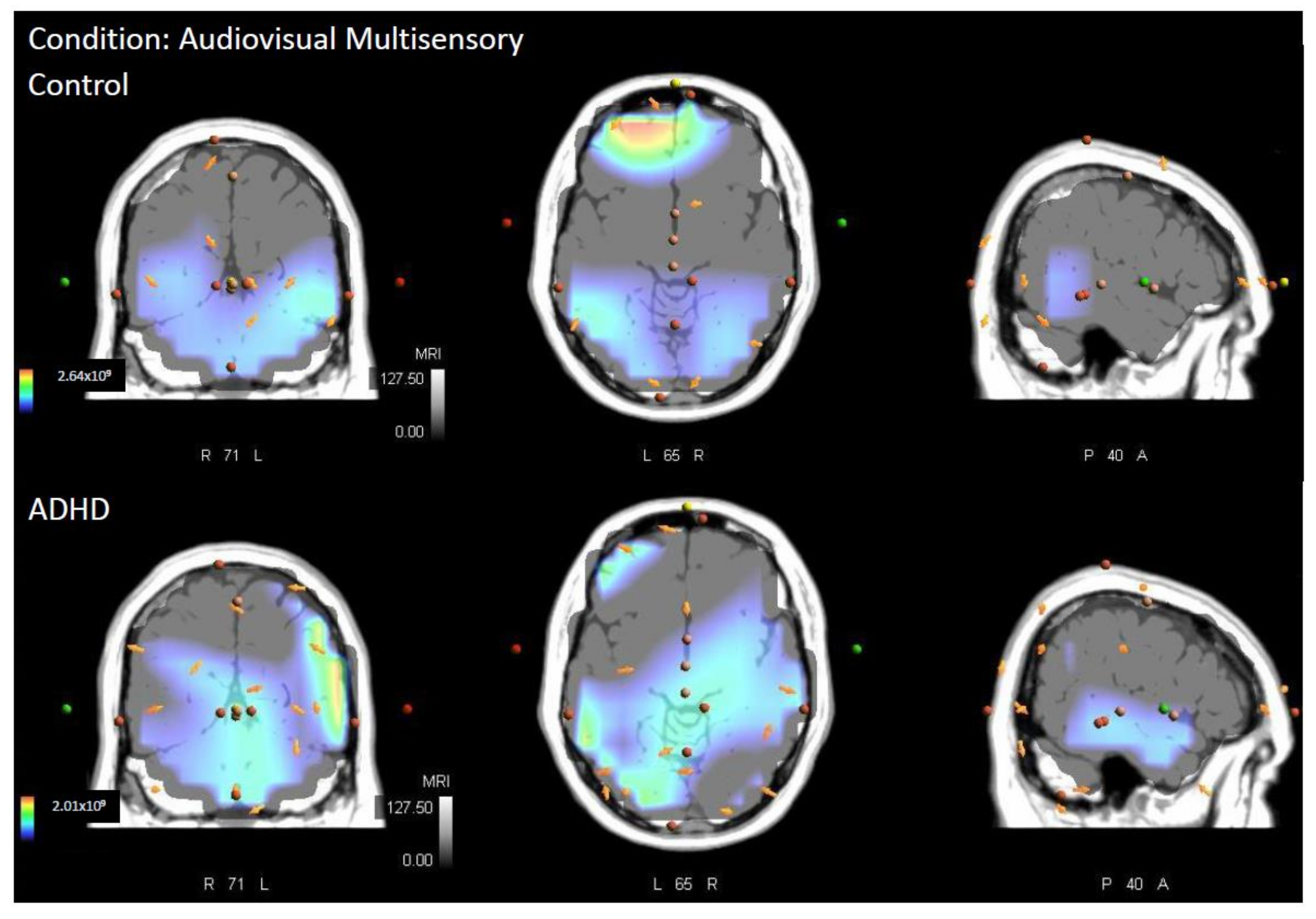 Brainsci 12 00809 g004
