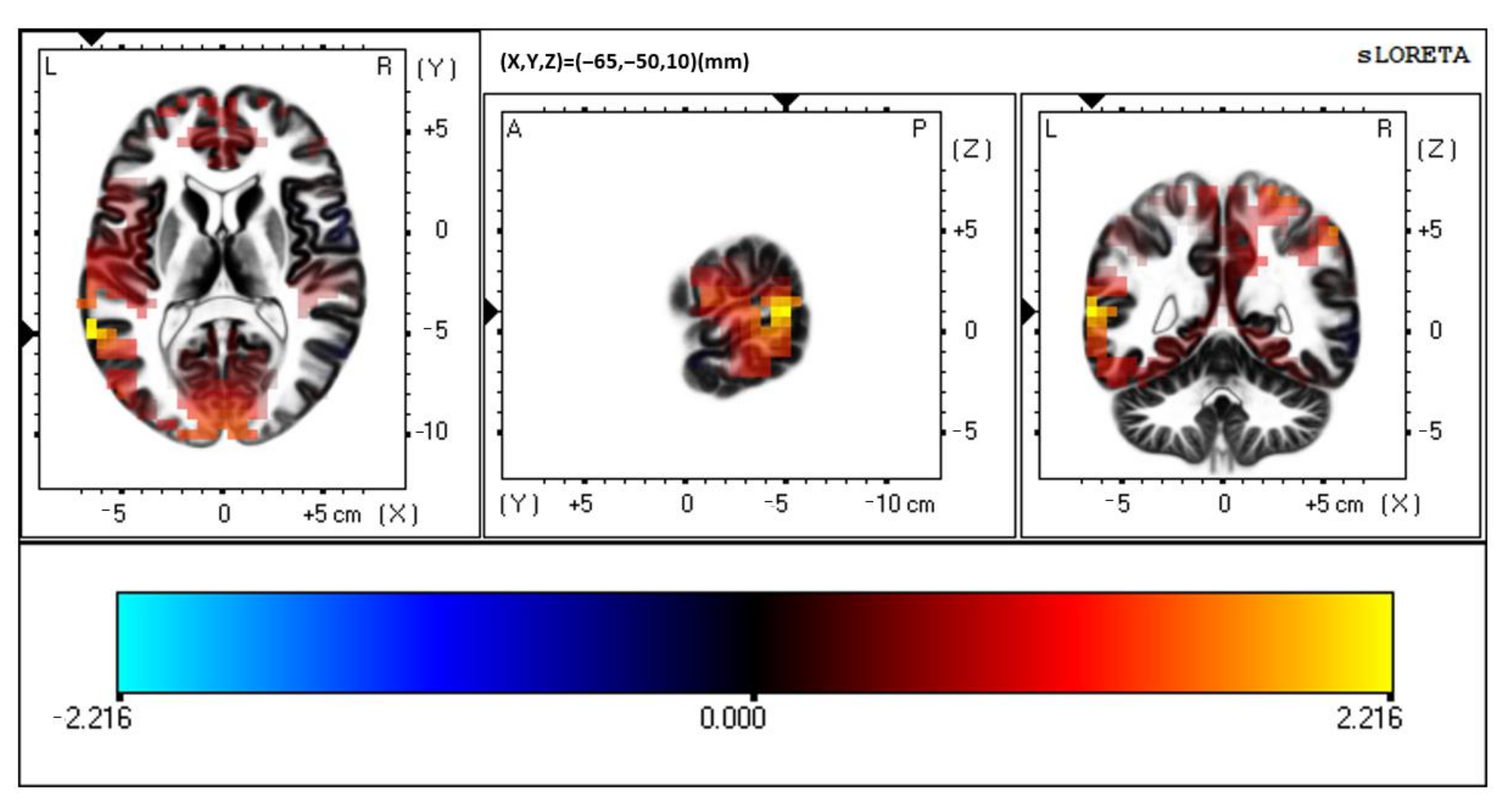 Brainsci 12 00809 g005