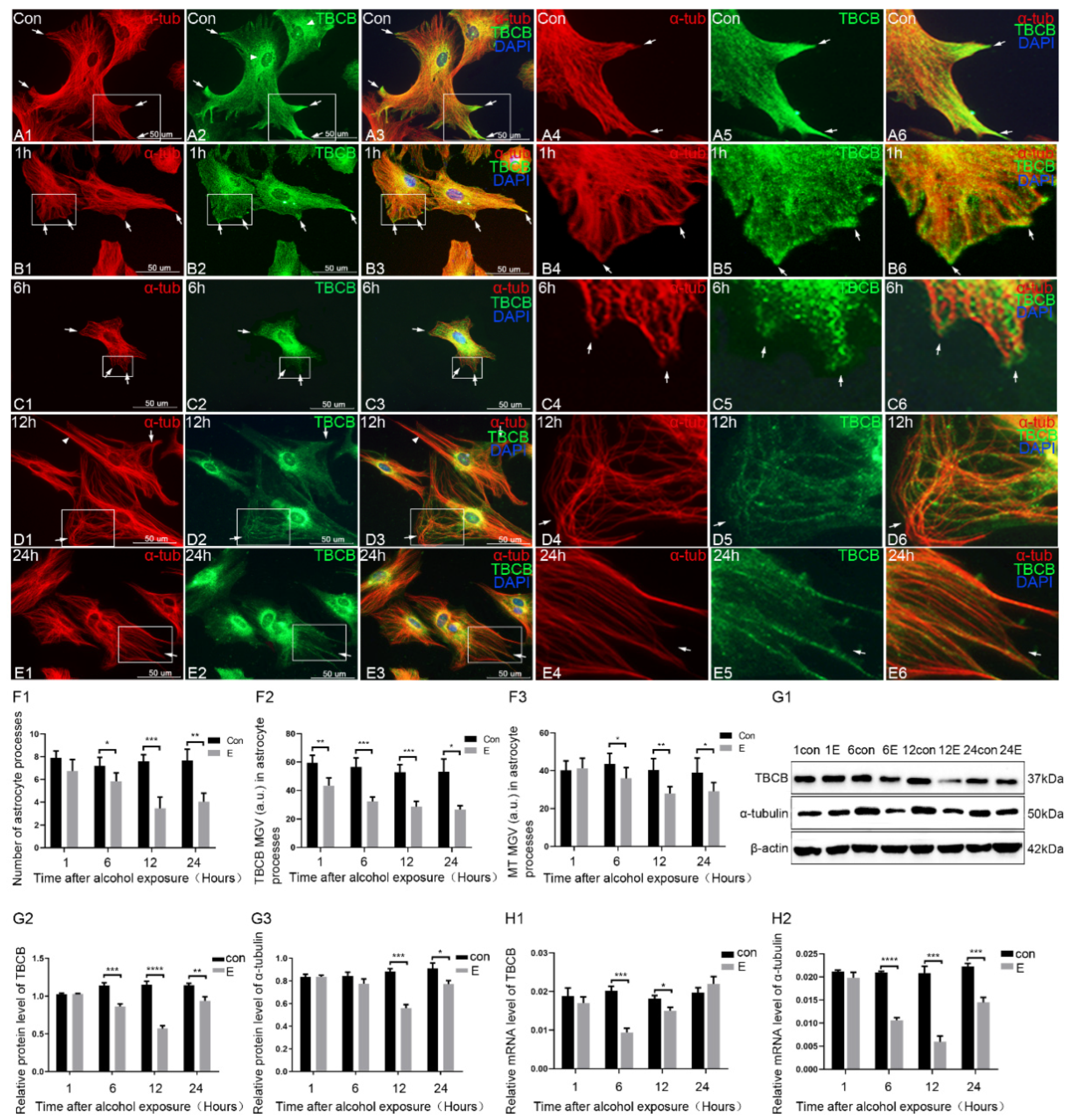 Brain Sciences Free Full-Text ERK1/2 Signalling Pathway Regulates Tubulin-Binding Cofactor B Expression and Affects Astrocyte Process Formation after Acute Foetal Alcohol Exposure