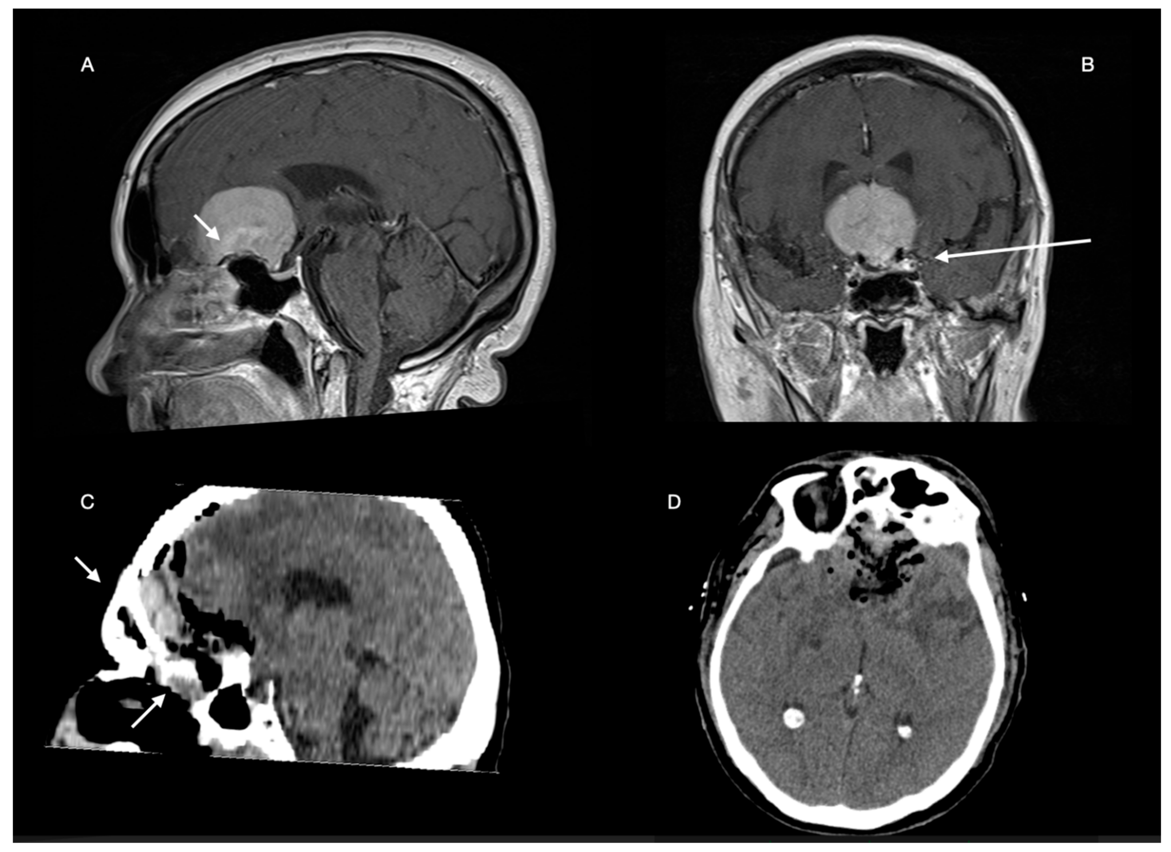 Brainsci 12 00817 g011