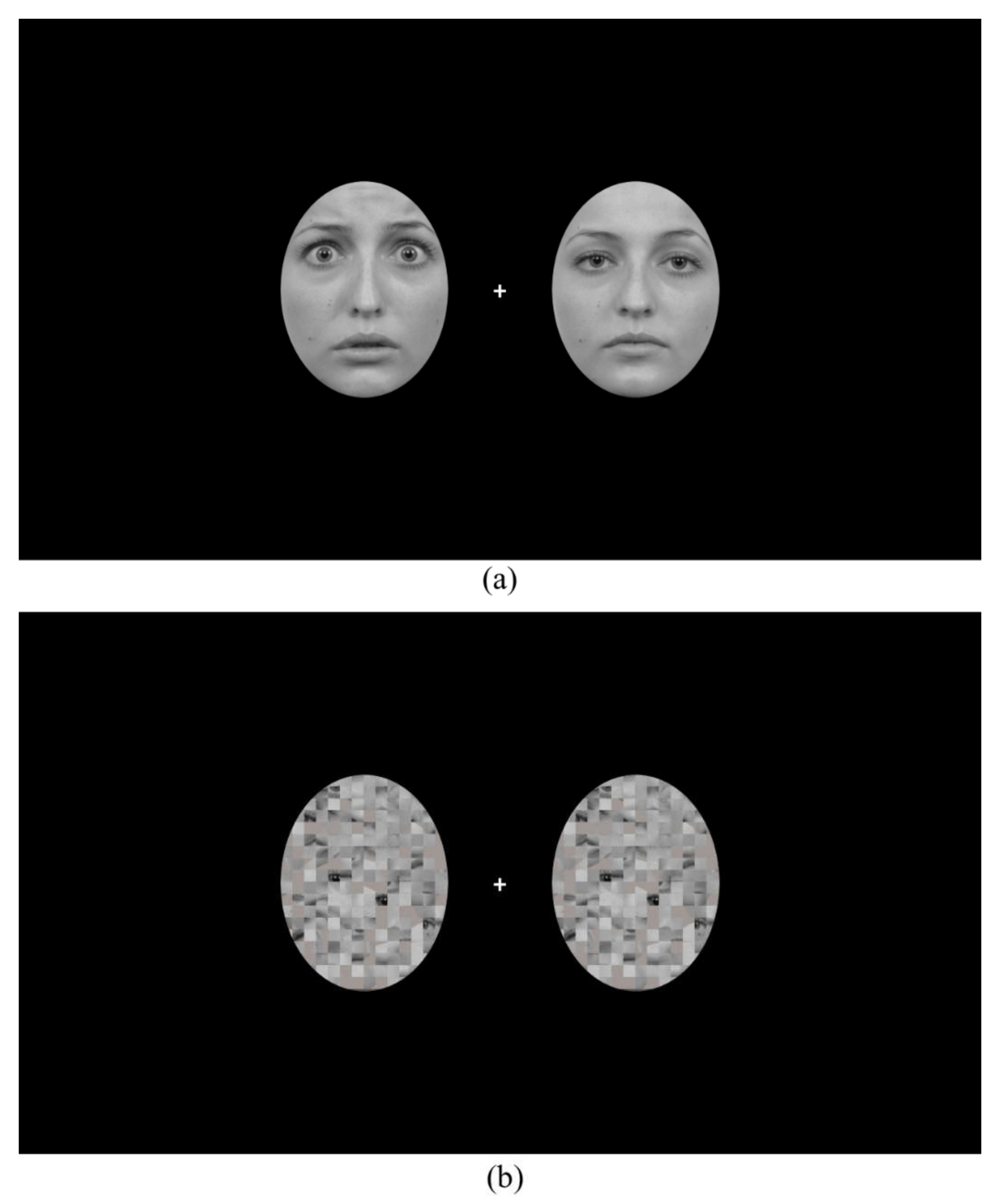 Brainsci 12 00823 g001