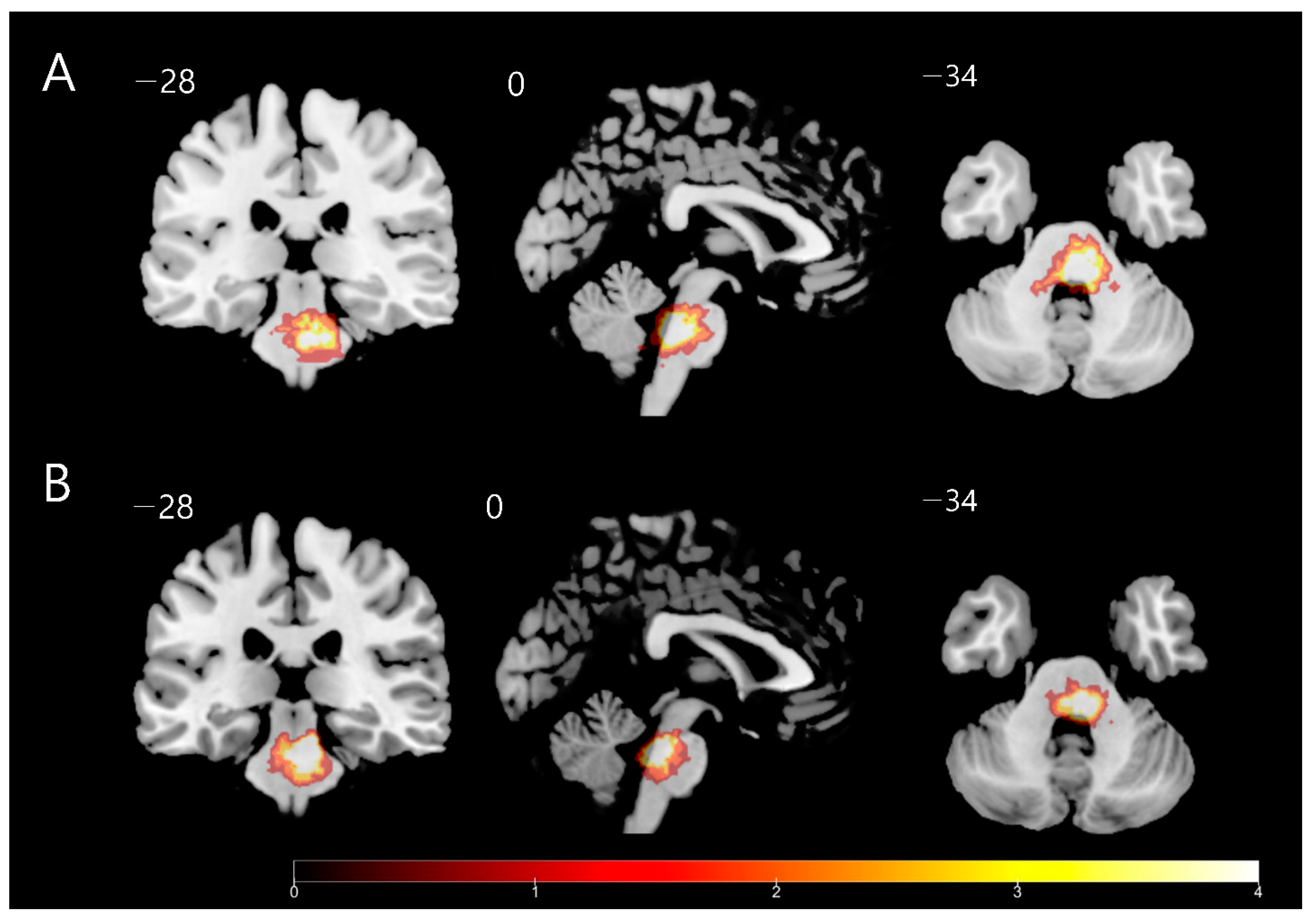 Brainsci 12 00837 g002 Brainsci 12 00837 g002