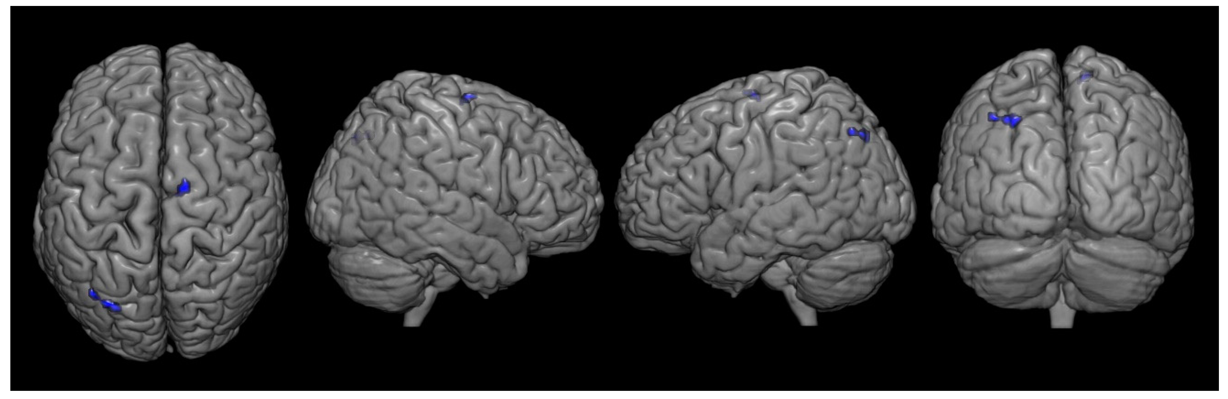 Brainsci 12 00837 g005 Brainsci 12 00837 g005