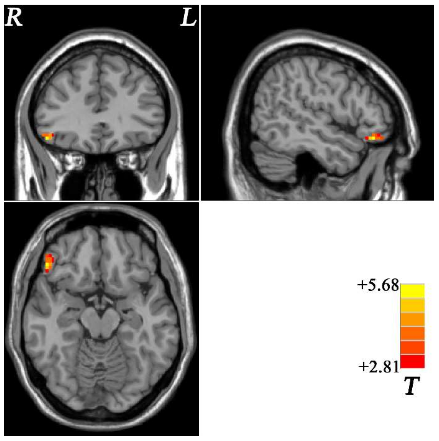 Brainsci 12 00857 g001