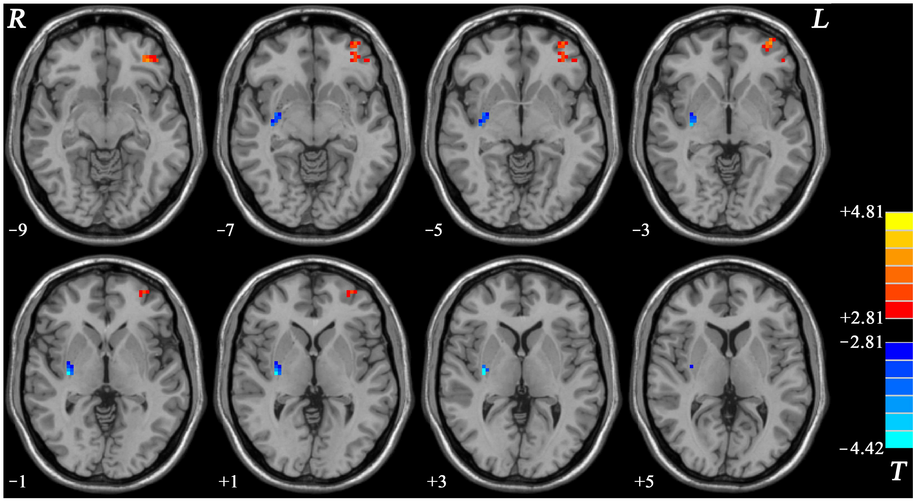 Brainsci 12 00857 g002
