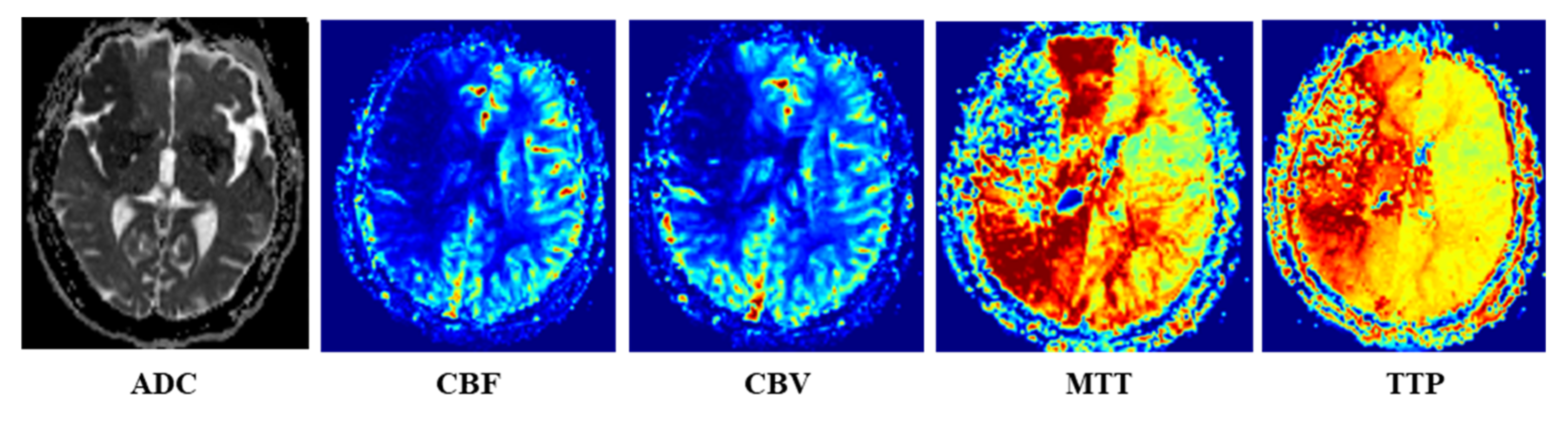 Brainsci 12 00858 g002