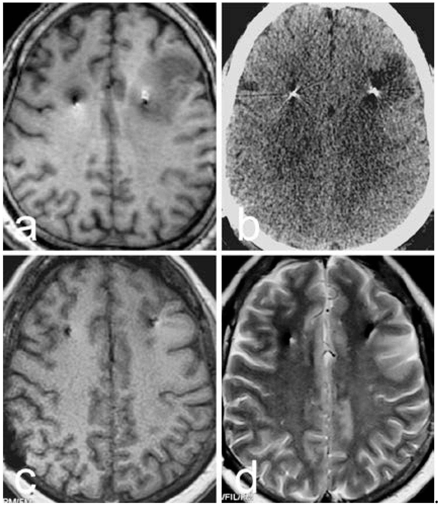 Brainsci 12 00881 g004
