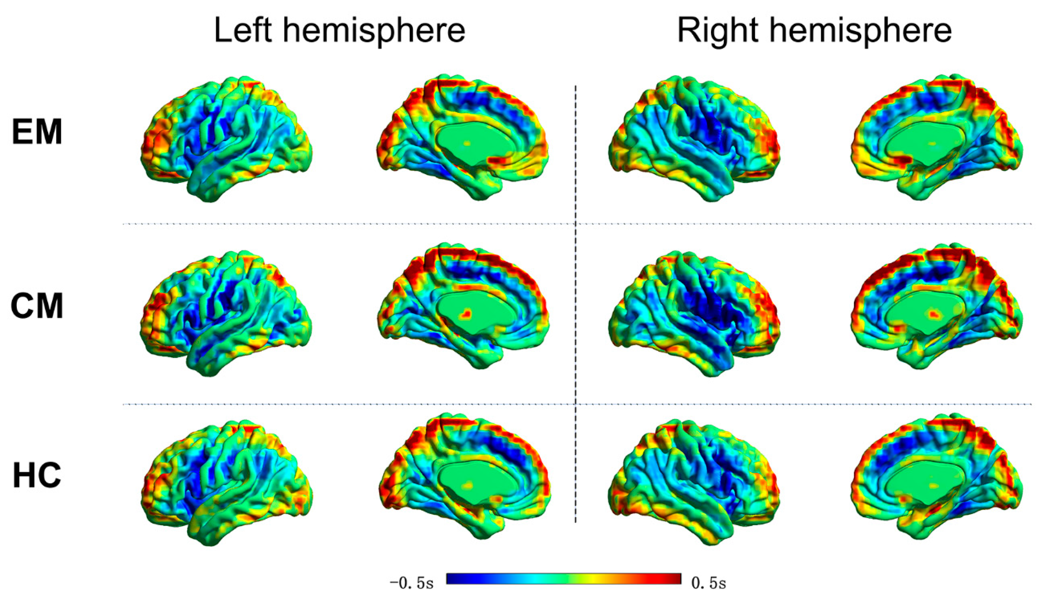 Reorganizations of latency structures within the white matter from