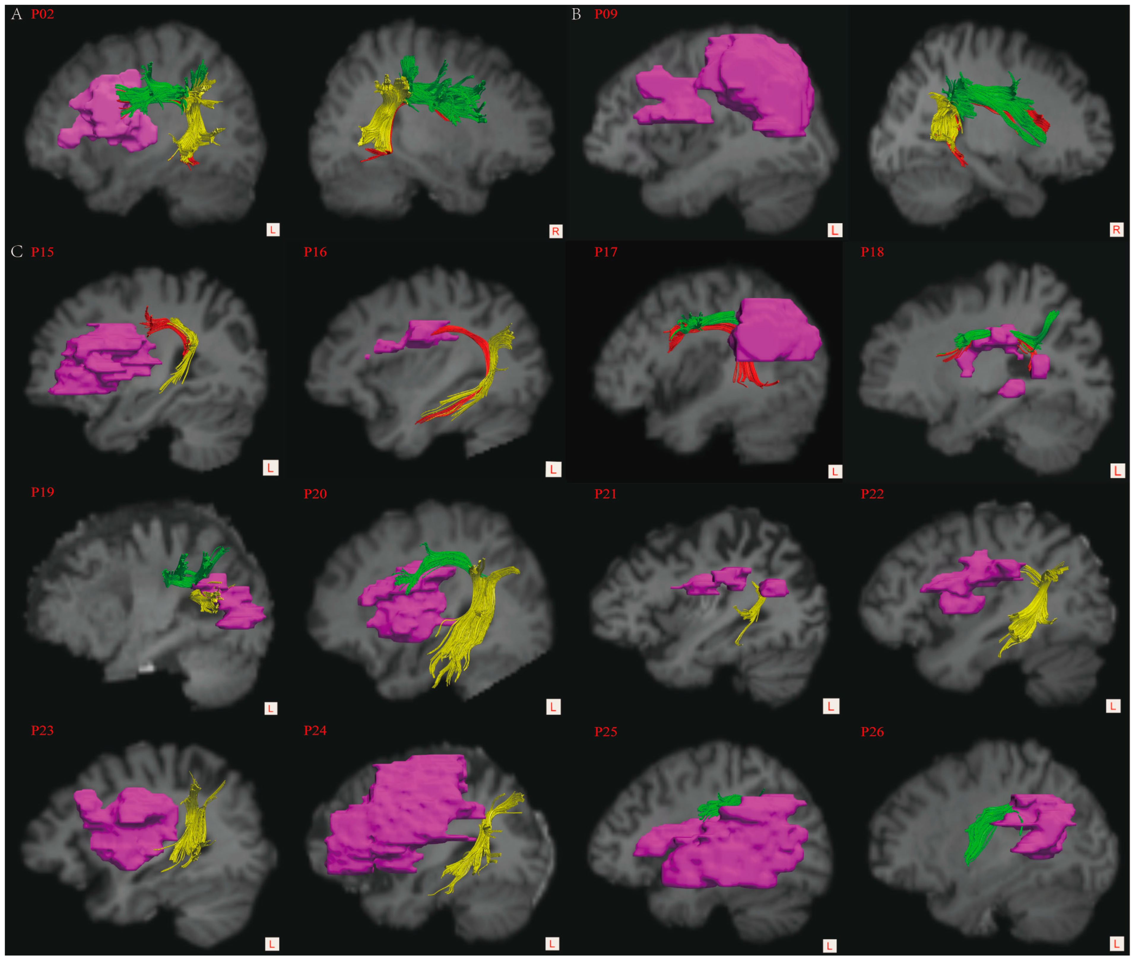 Brainsci 12 00907 g002 Brainsci 12 00907 g002