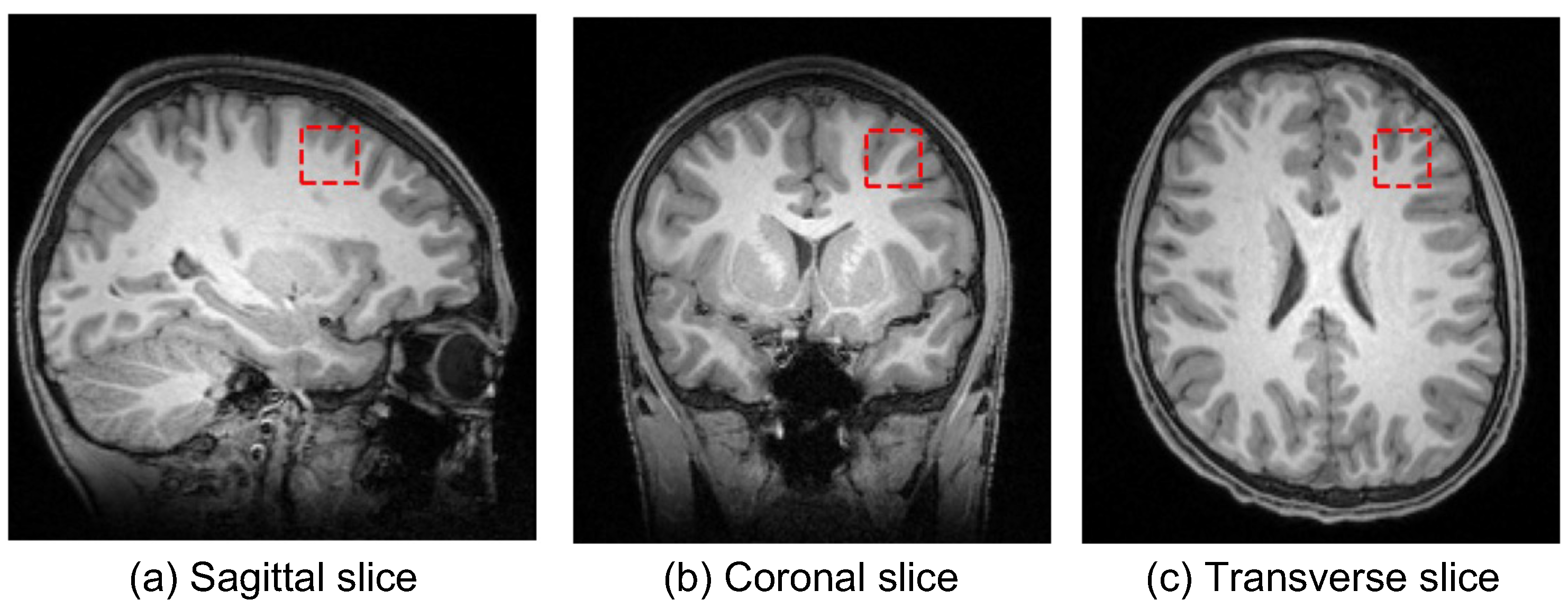 Brainsci 12 00908 g001