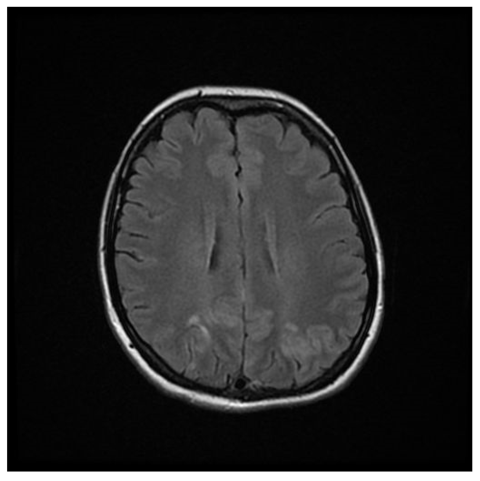 Brainsci 12 00915 g002 550