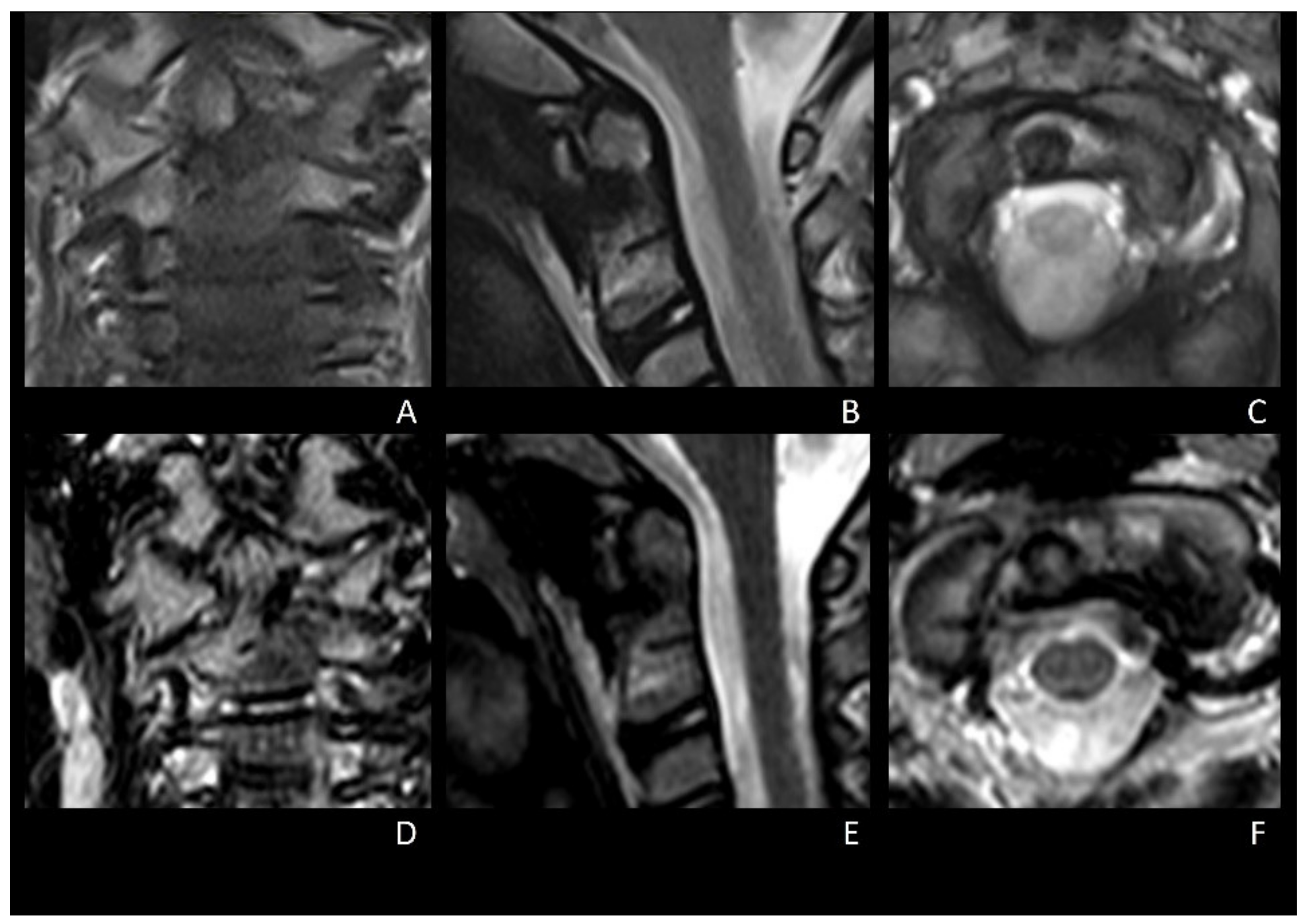 Brainsci 12 00916 g004 Brainsci 12 00916 g004