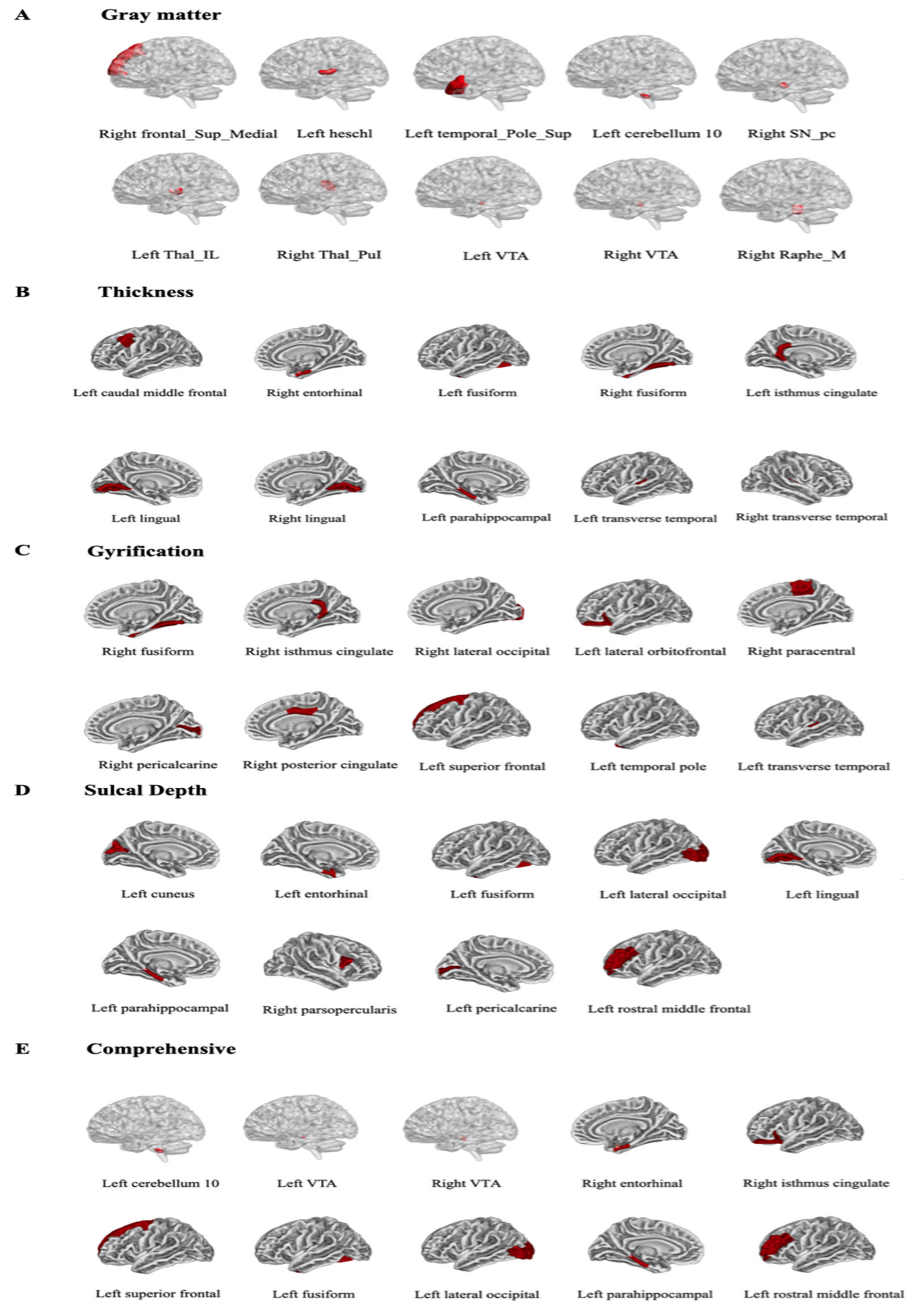Brainsci 12 00921 g002 Brainsci 12 00921 g002