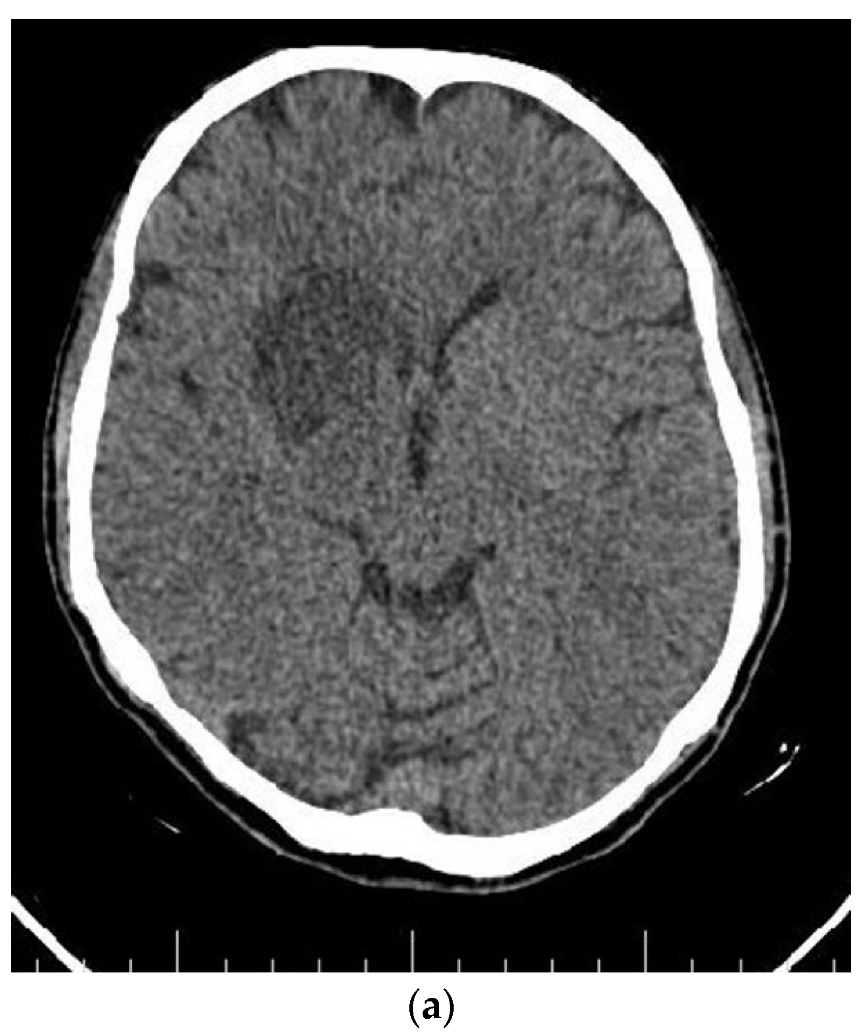 Brainsci 12 00958 g004a