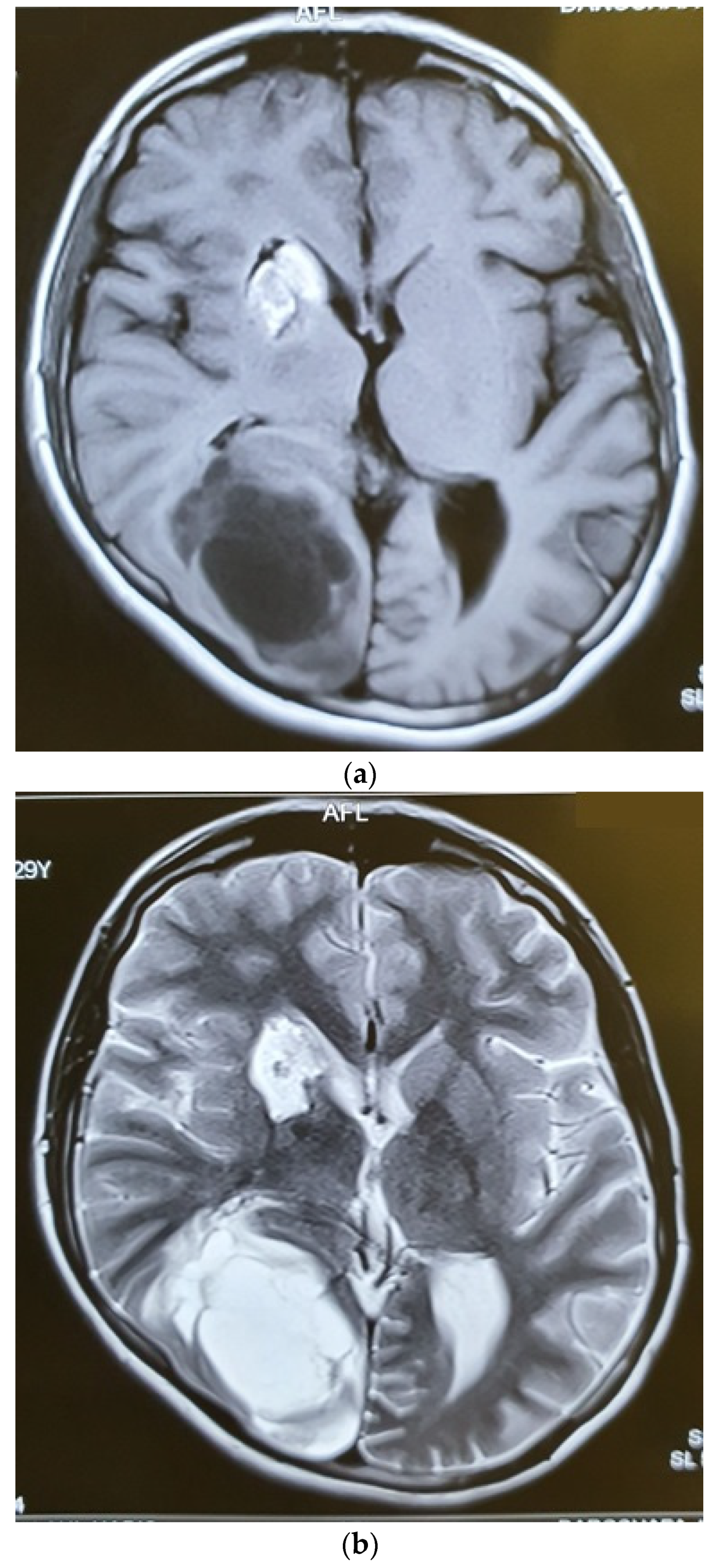Brainsci 12 00958 g006a